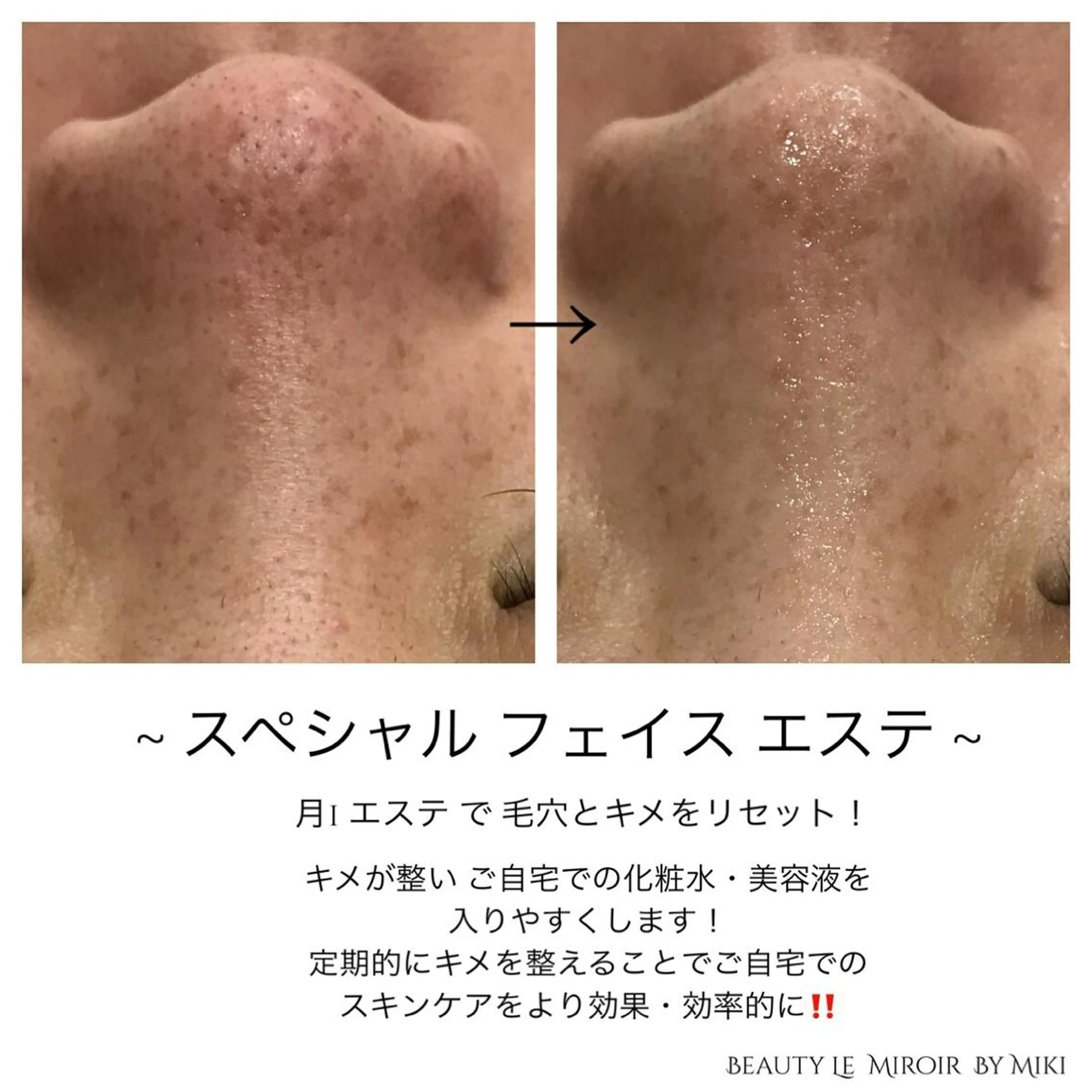 ビューティー ミロワールのエステ・リラクイメージ