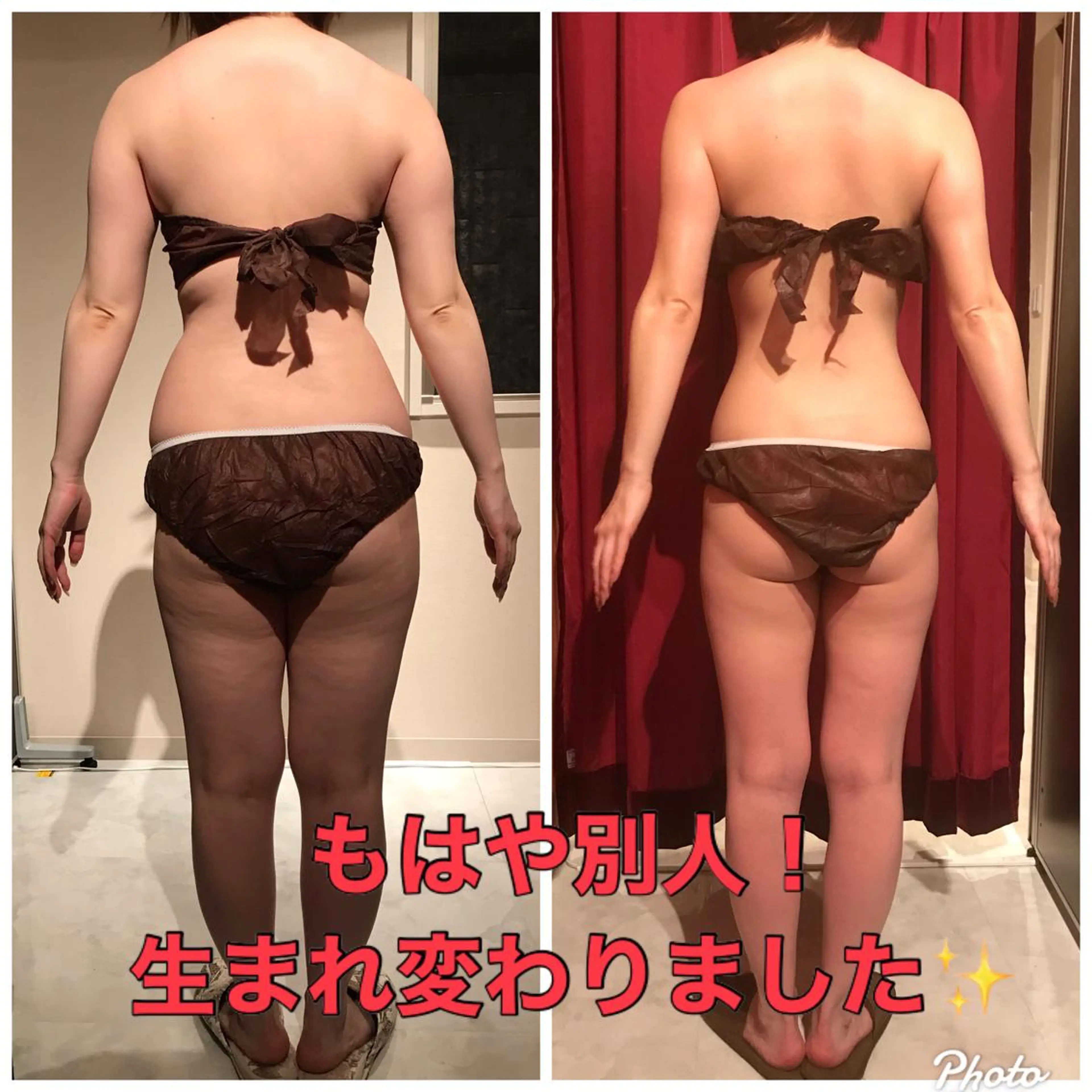 【カスタマイズ痩身90】強圧ハンド＆セル撃退マシンで効果実感◎人気のダイエットメニュー★くびれ、脚痩せ、二の腕痩せ★の写真