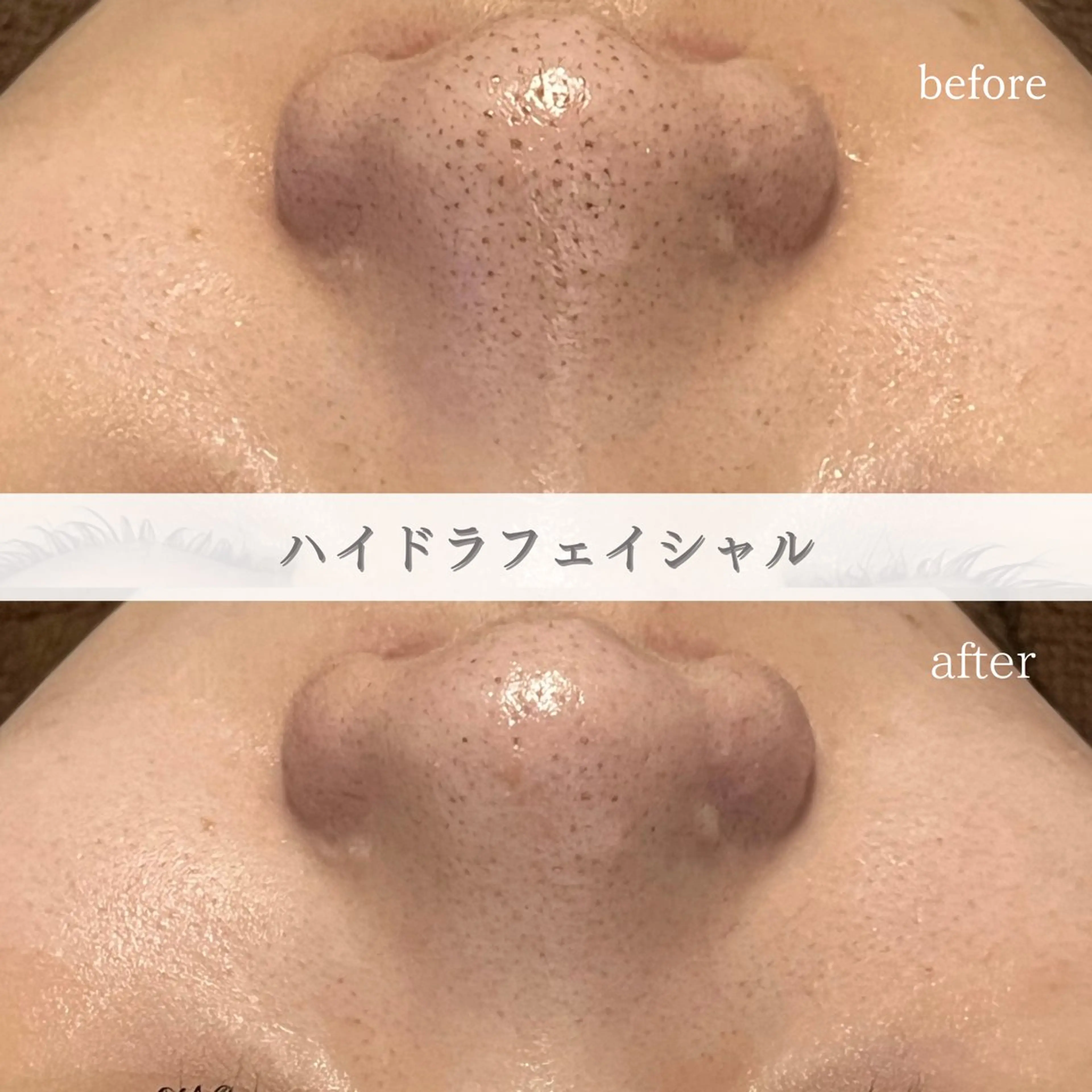 ENCHANT Kaede/肌質改善のその他イメージ