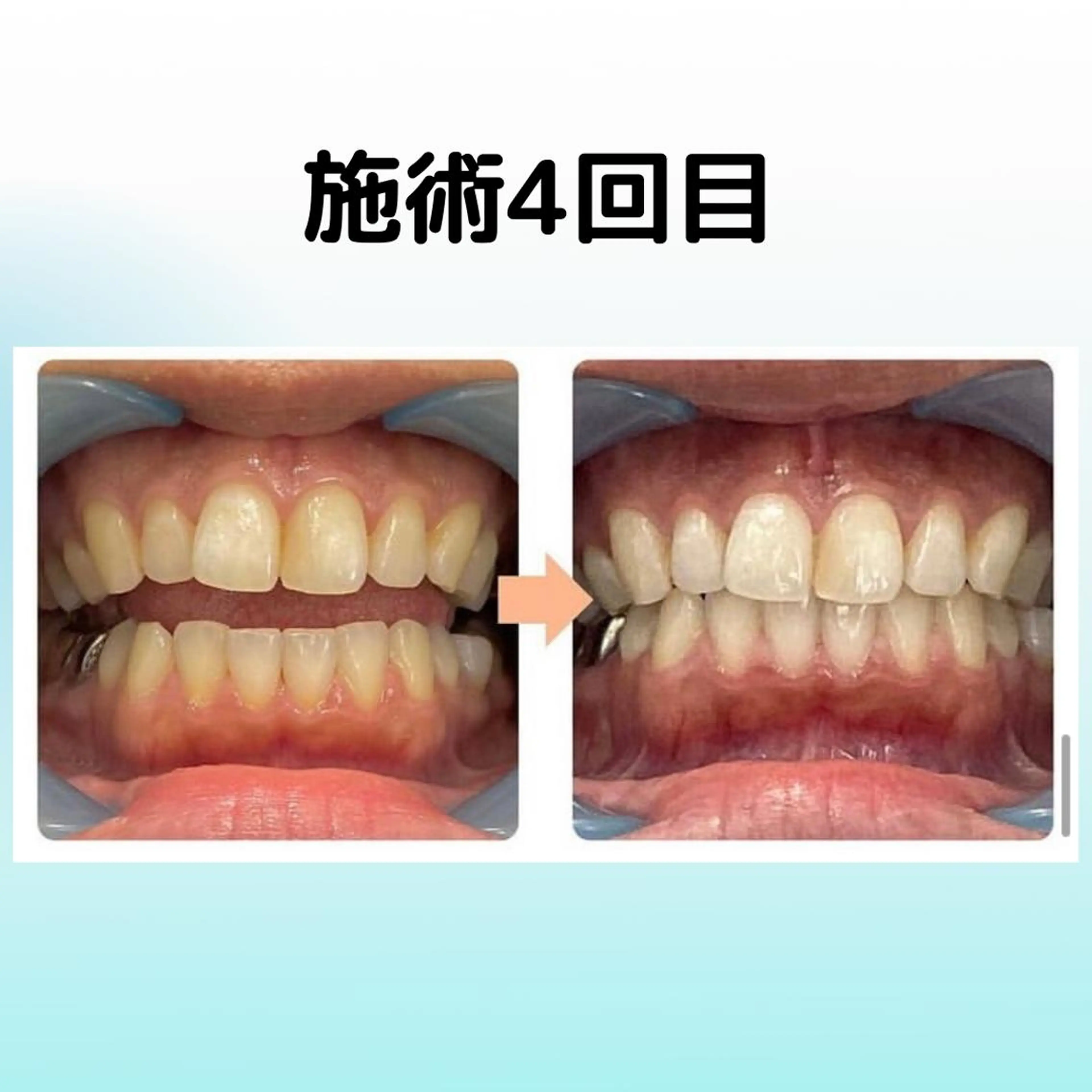 その他 ホワイトニングシャトン所属・ホワイトニング シャトンのその他イメージ