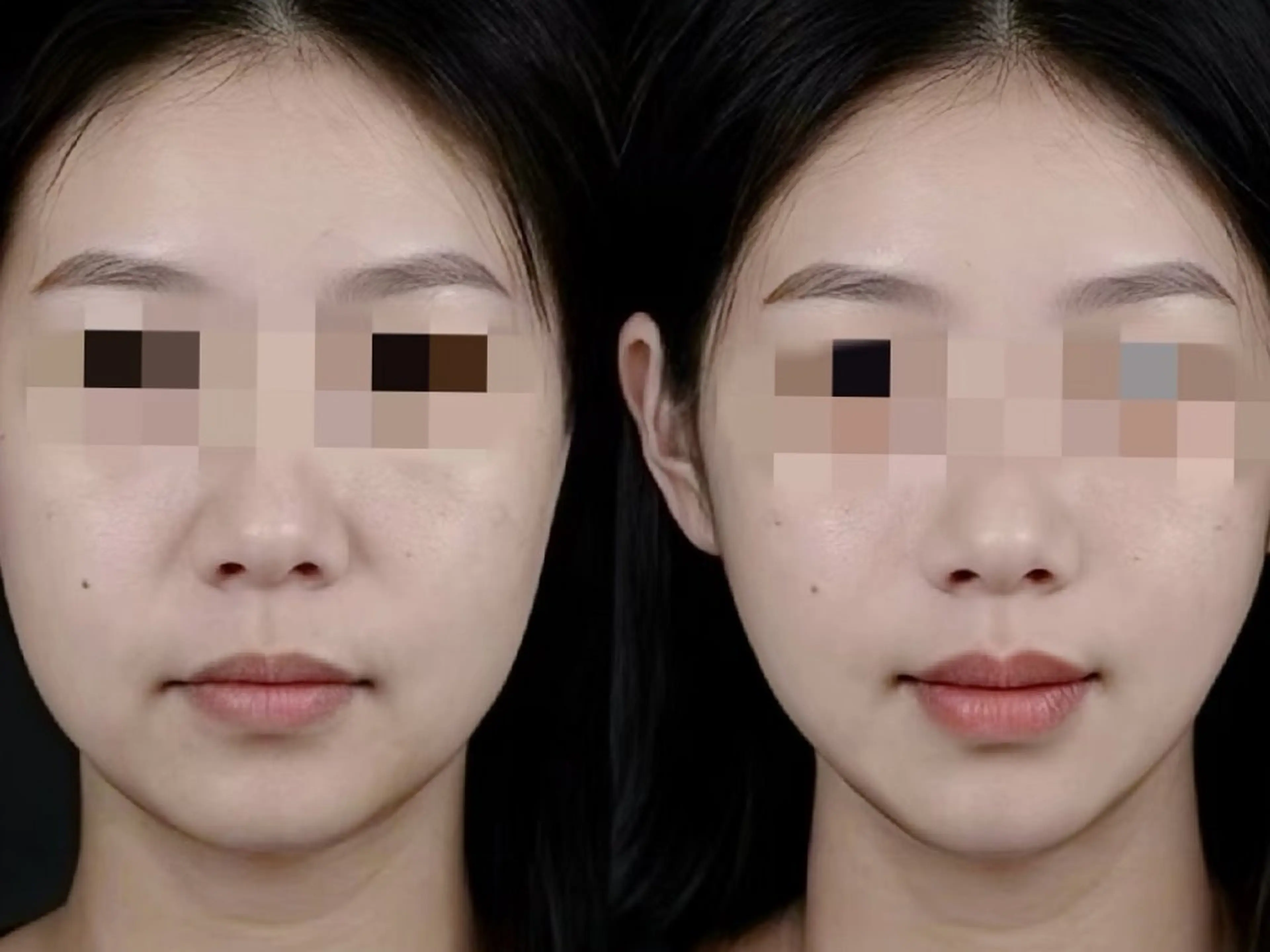 エステ aliaハイフ&水光ジェットサロン所属・aliaハーブ水光店 エステティシャン募集のエステ・リラクイメージ