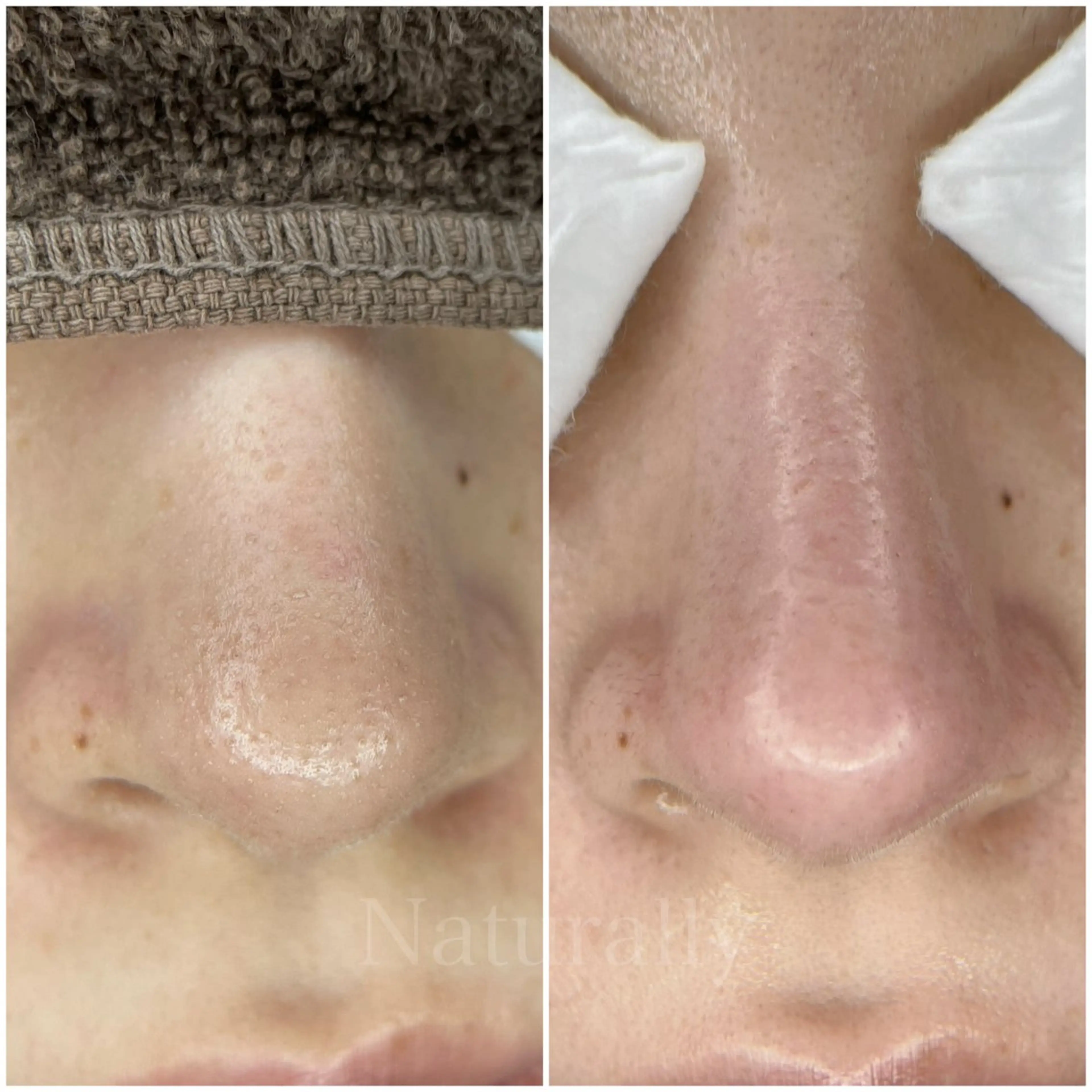 Naturally ナチュラリーのマツエク・マツパデザイン