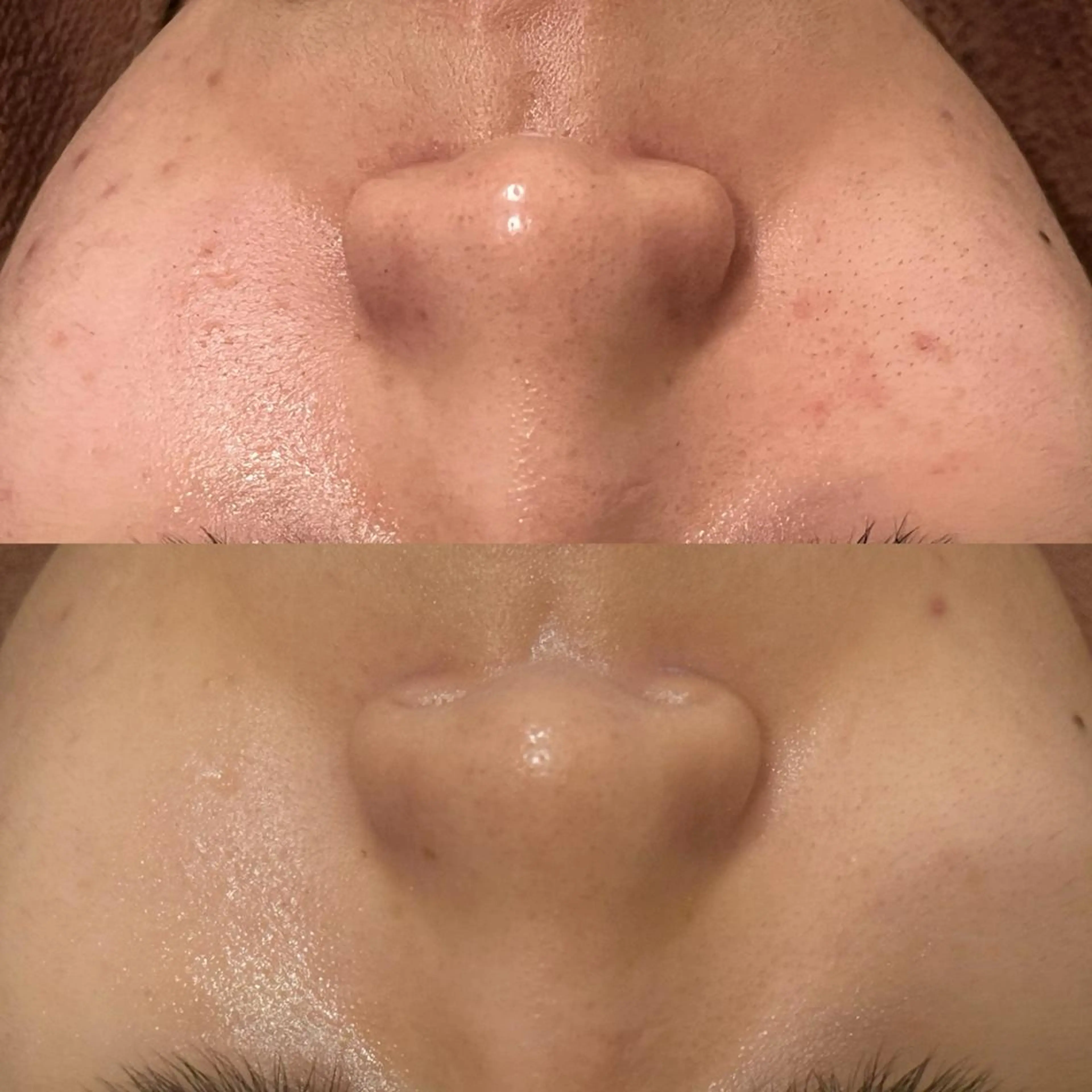 触れたくなる モテ肌へ...❤︎のエステ・リラクイメージ