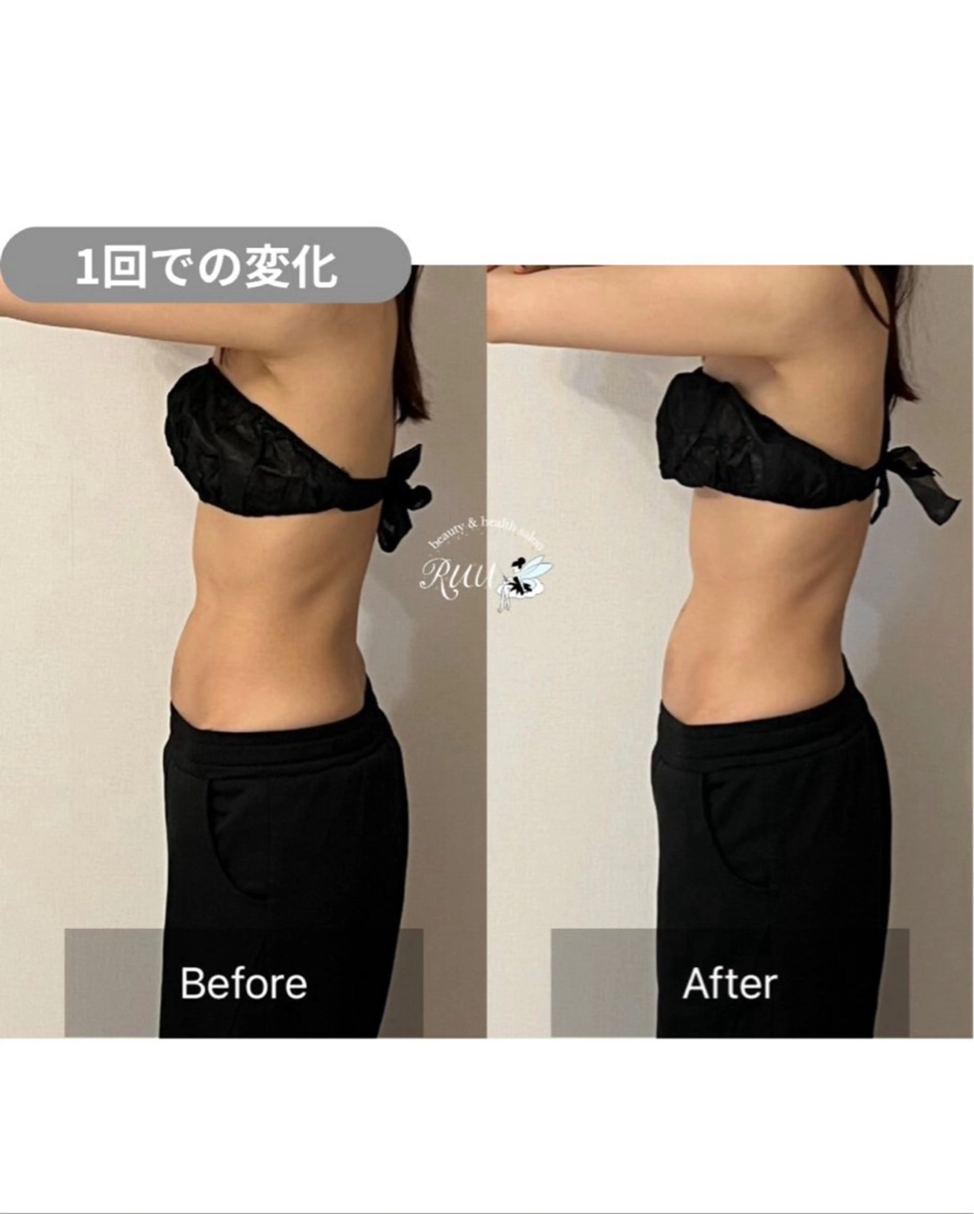 【頭痛、睡眠改善】 salon RUUのエステ・リラクイメージ