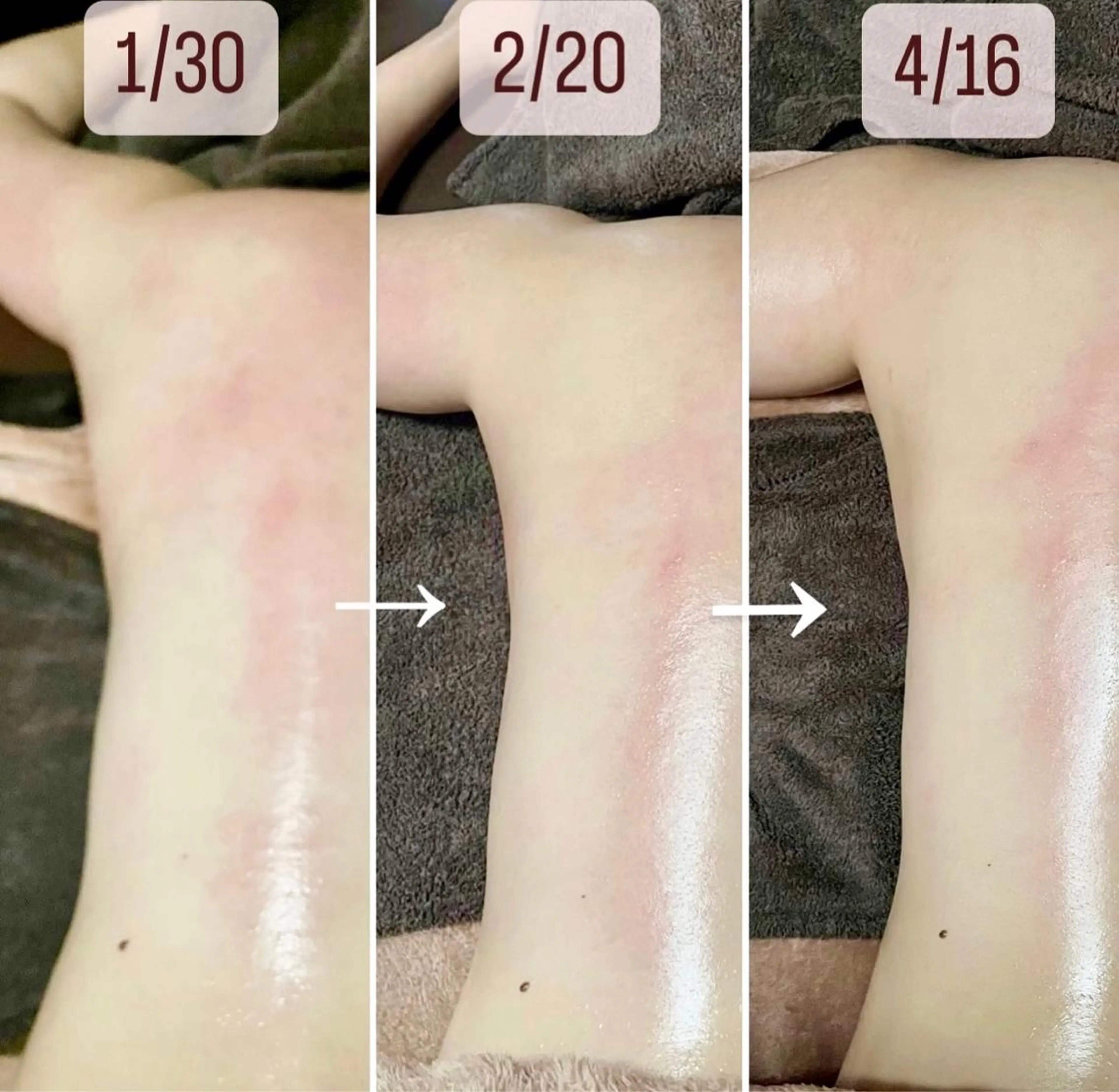 アイカワールド所属・鈴木 愛加のエステ・リラクイメージ