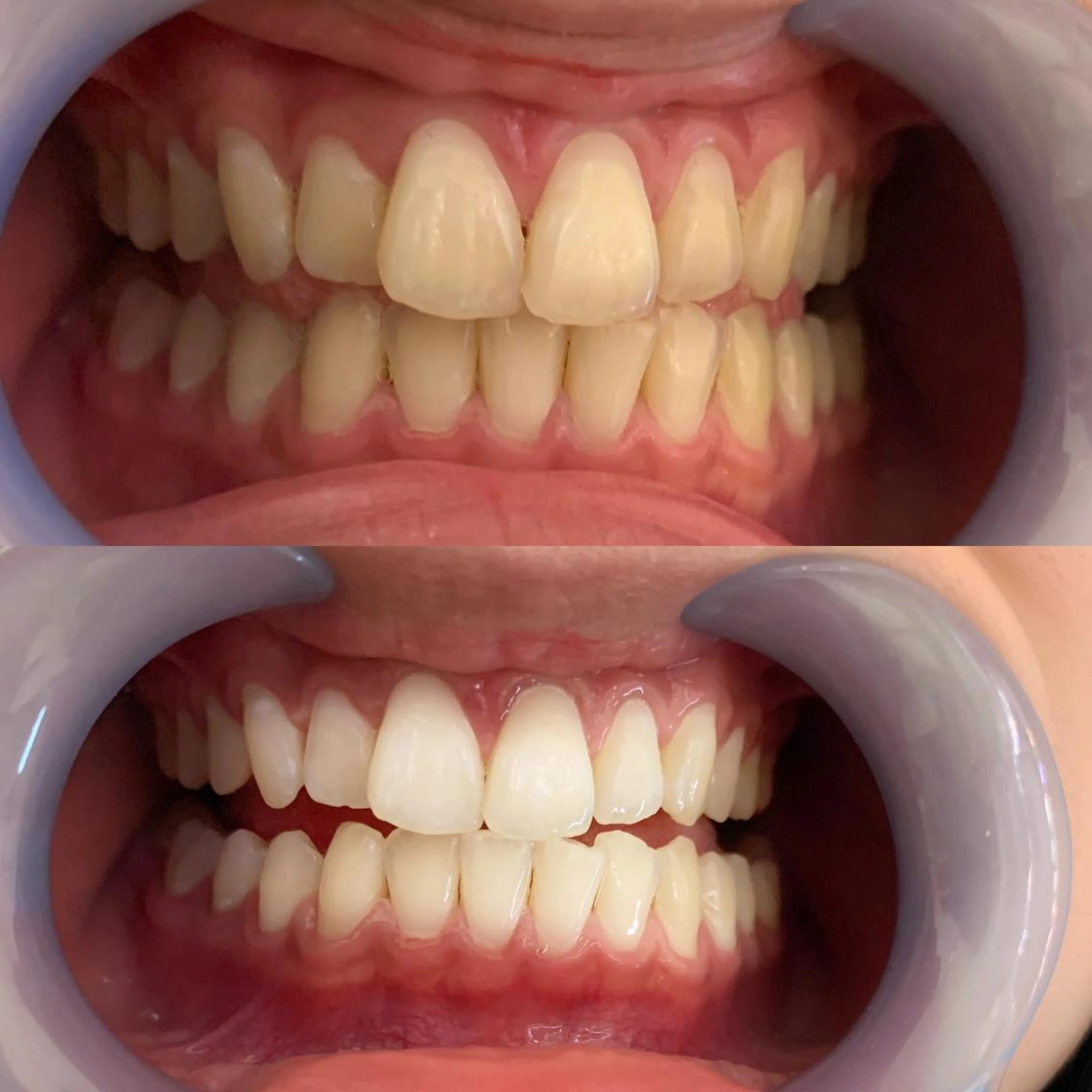 LOVE ホワイトニング新宿店のエステ・リラクイメージ