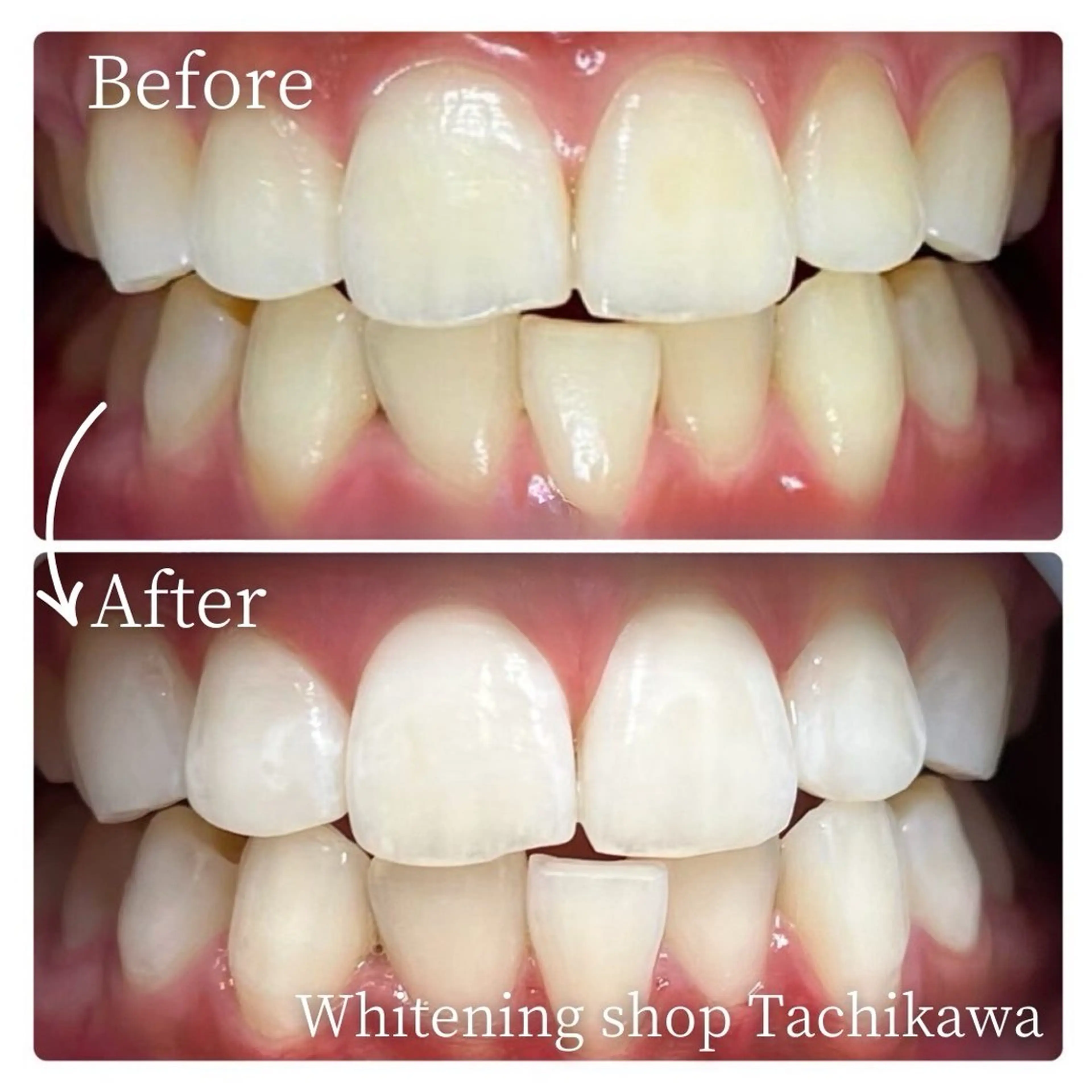 セルフ　ホワイト ニングショップ立川のその他イメージ