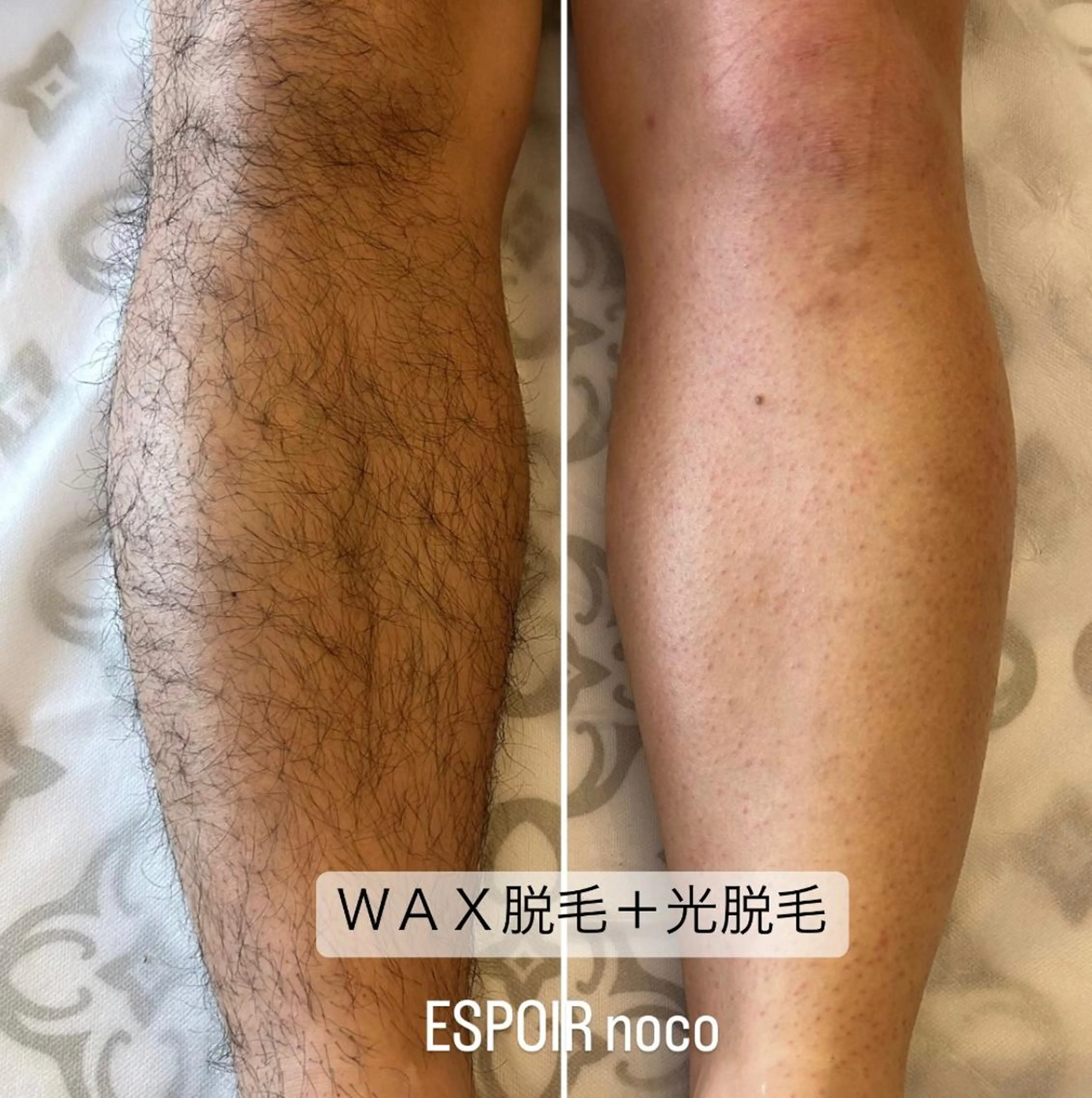メンズ ワックス脱毛🌈 ESPOIRnocoのエステ・リラクイメージ