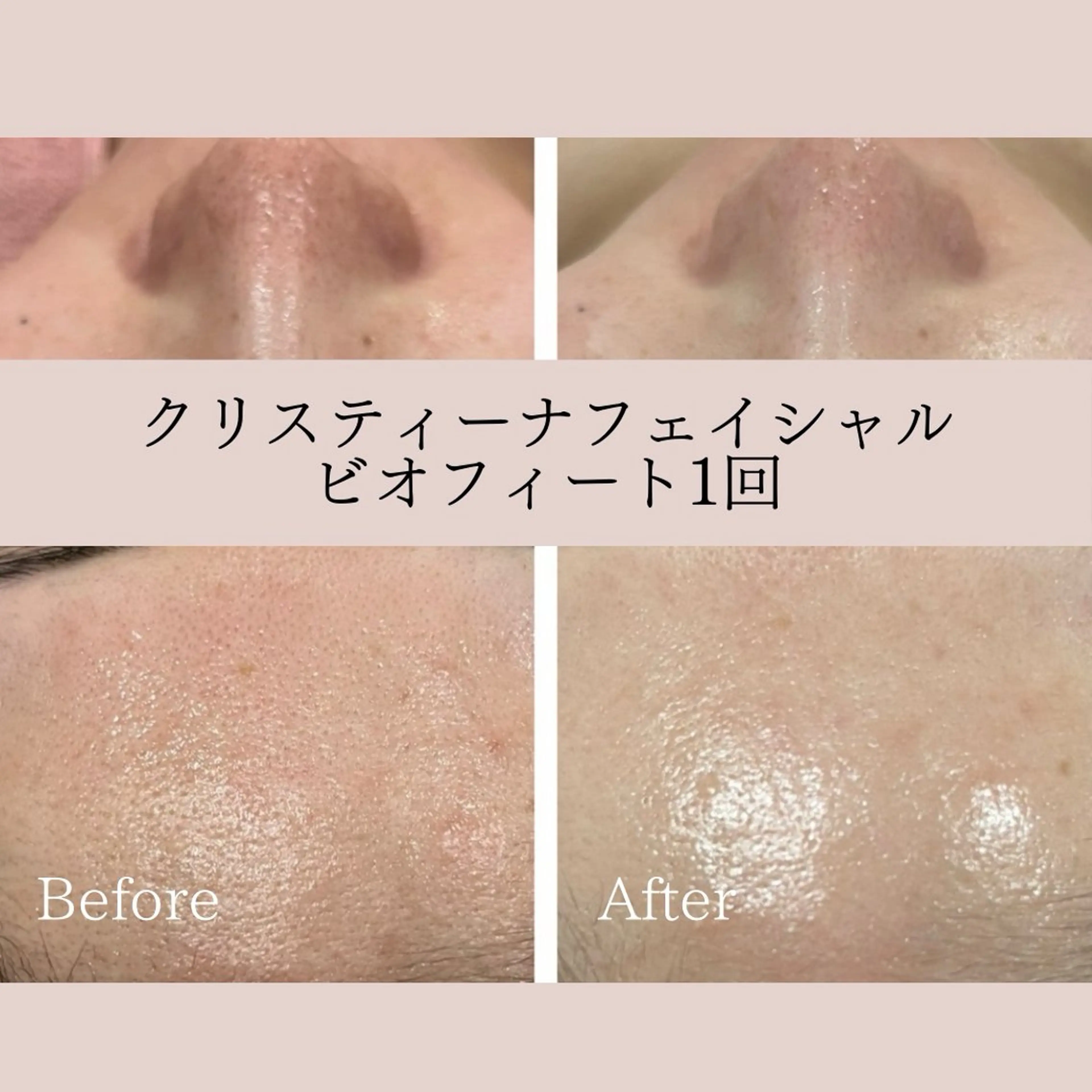 フェイシャル/脱毛 ジョアアンジェ竹田のエステ・リラクイメージ