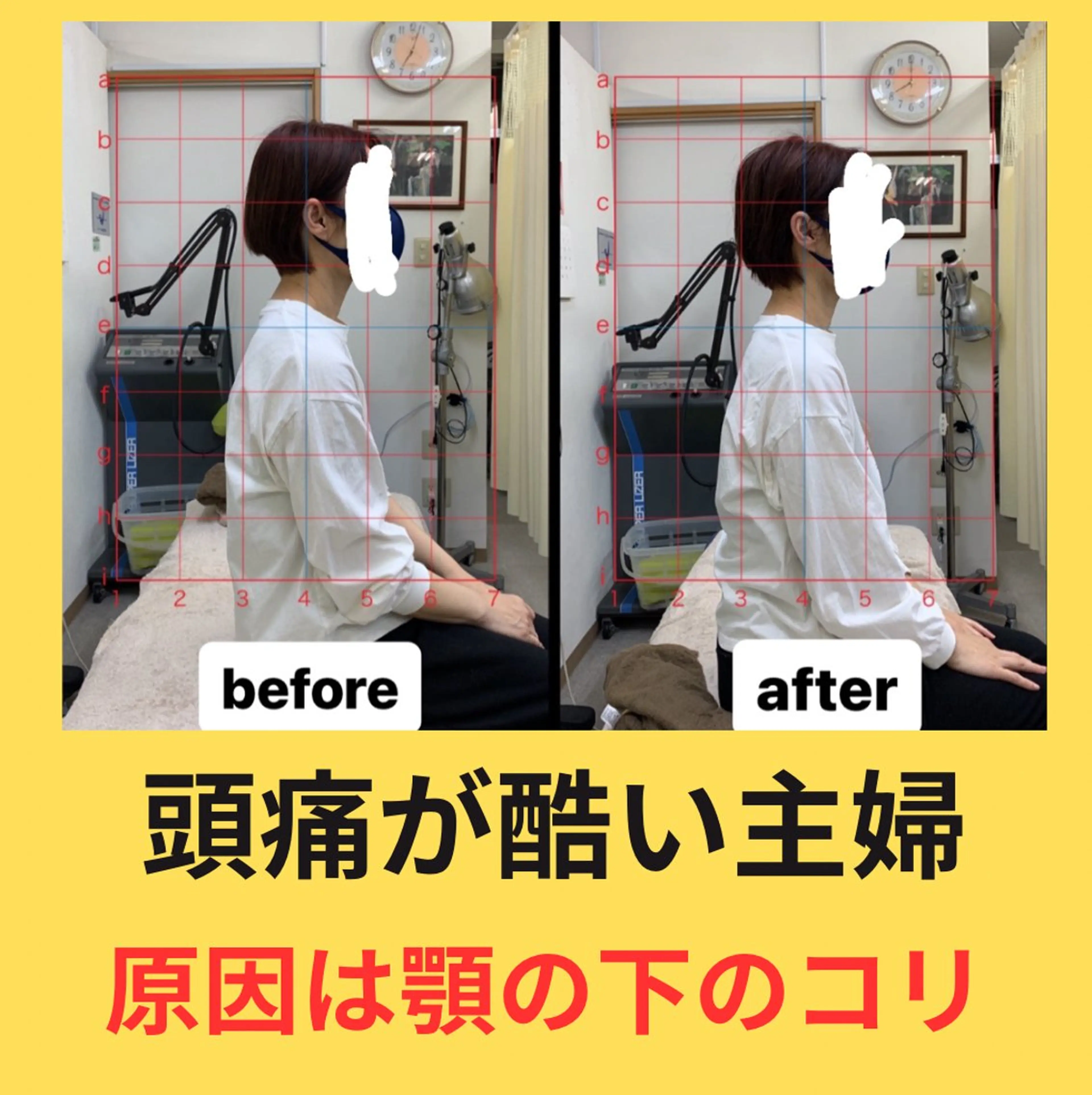 肩こり頭痛さようなら 整体カタギリのエステ・リラクイメージ