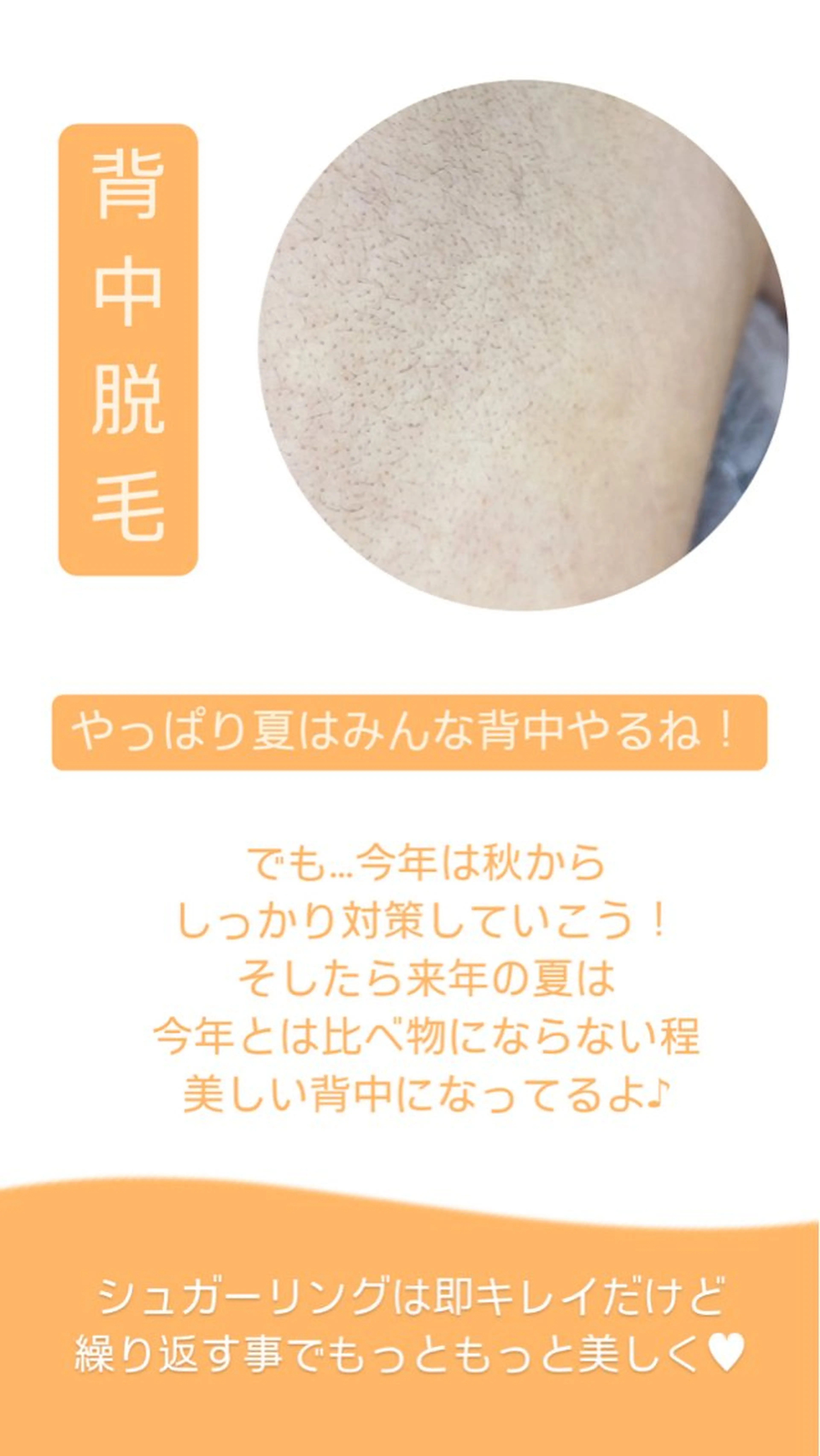 Hit. シュガーリング豊橋のエステ・リラクイメージ