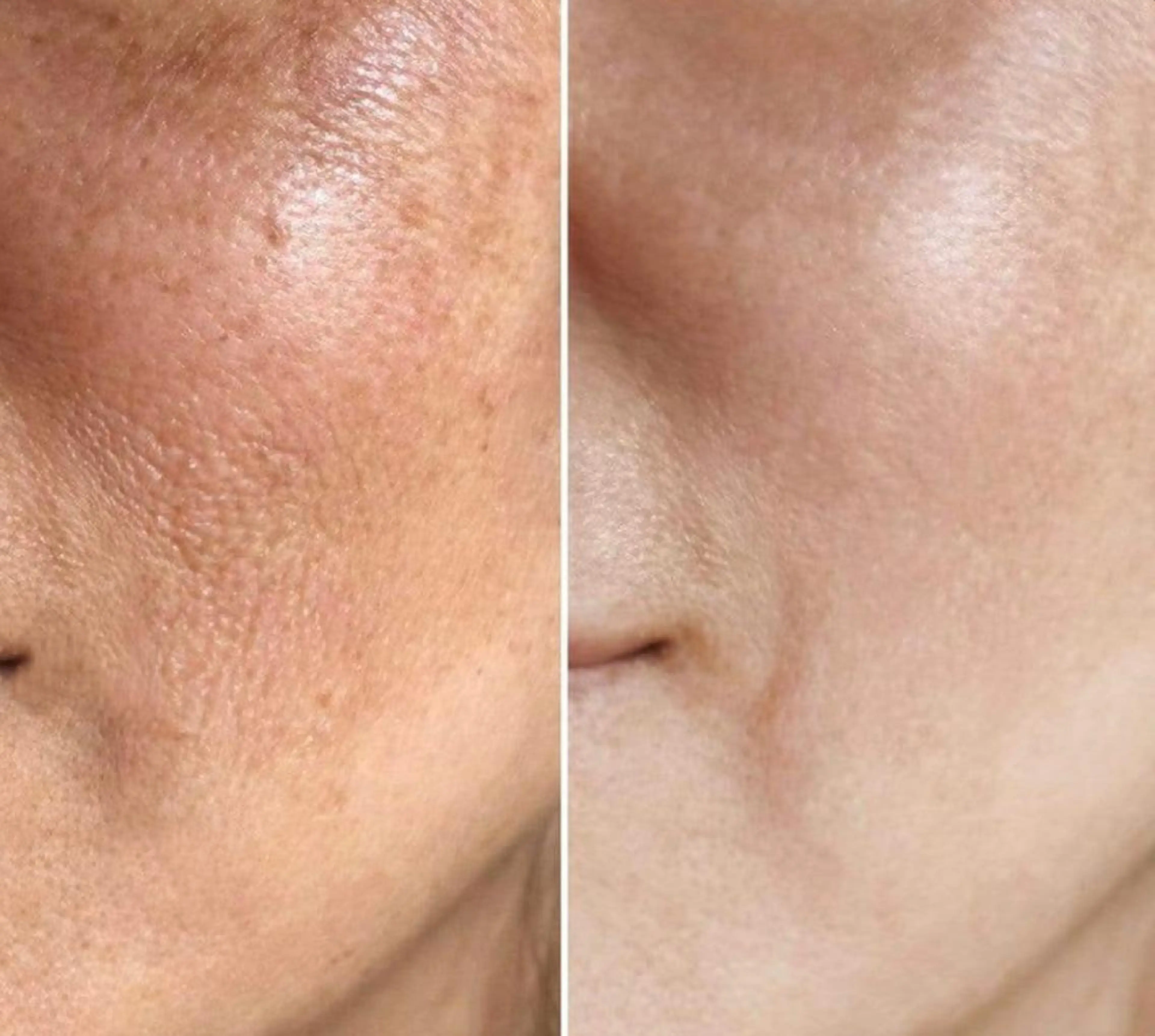 自爪育成ネイルサロン ココリュバンのネイルデザイン