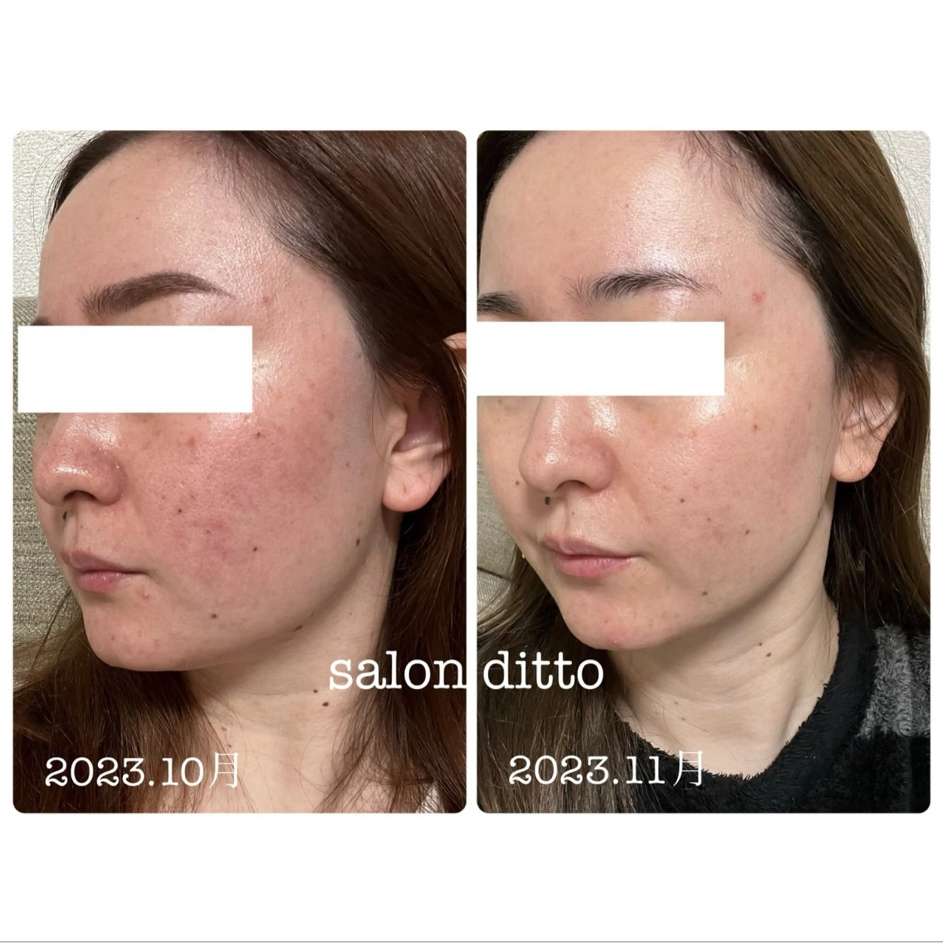 エステ リラク salon ditto所属・mio (小顔・ヘッドスパ)のエステ・リラクイメージ