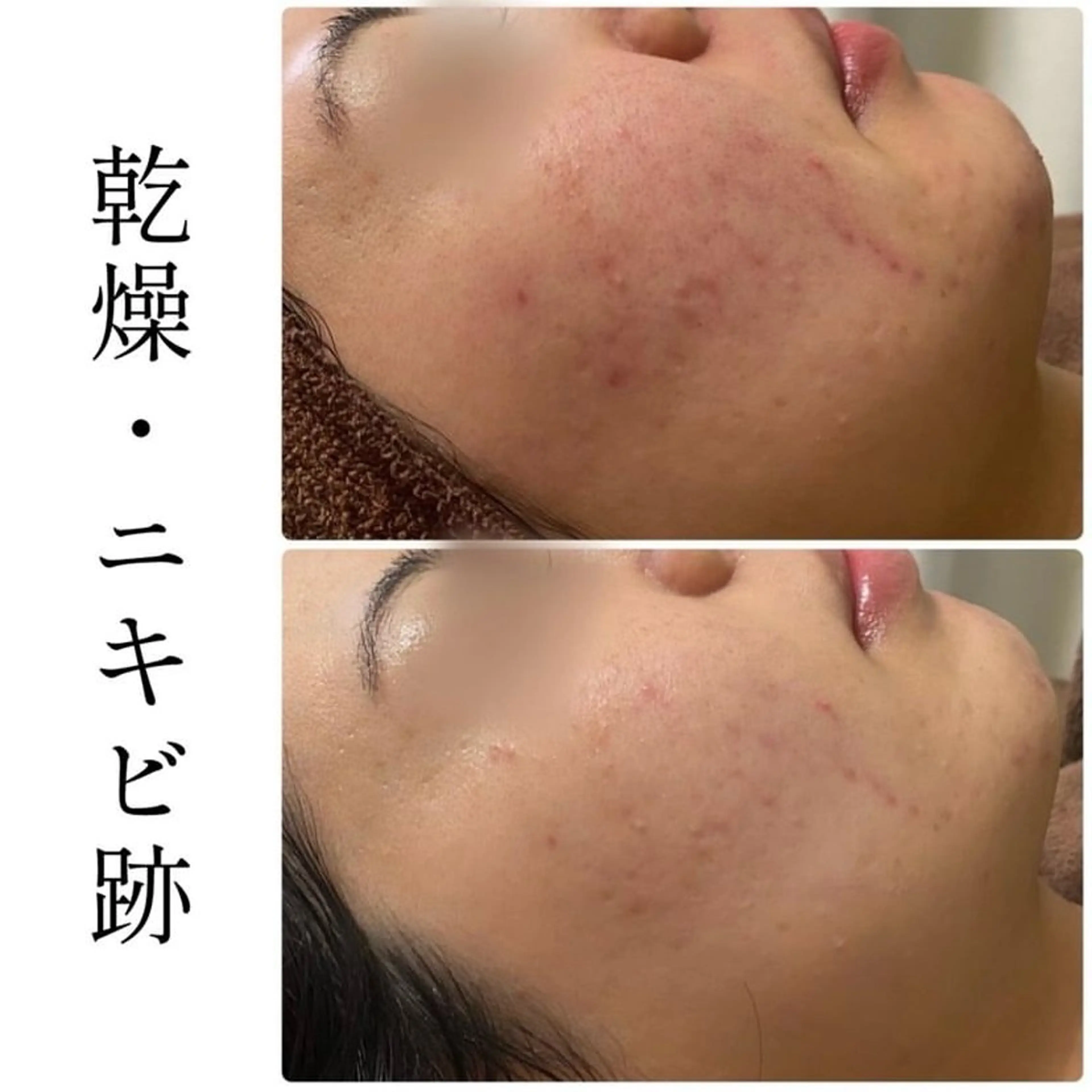 エステ ハーブピーリング専門 BIOEL横浜のエステ・リラクイメージ