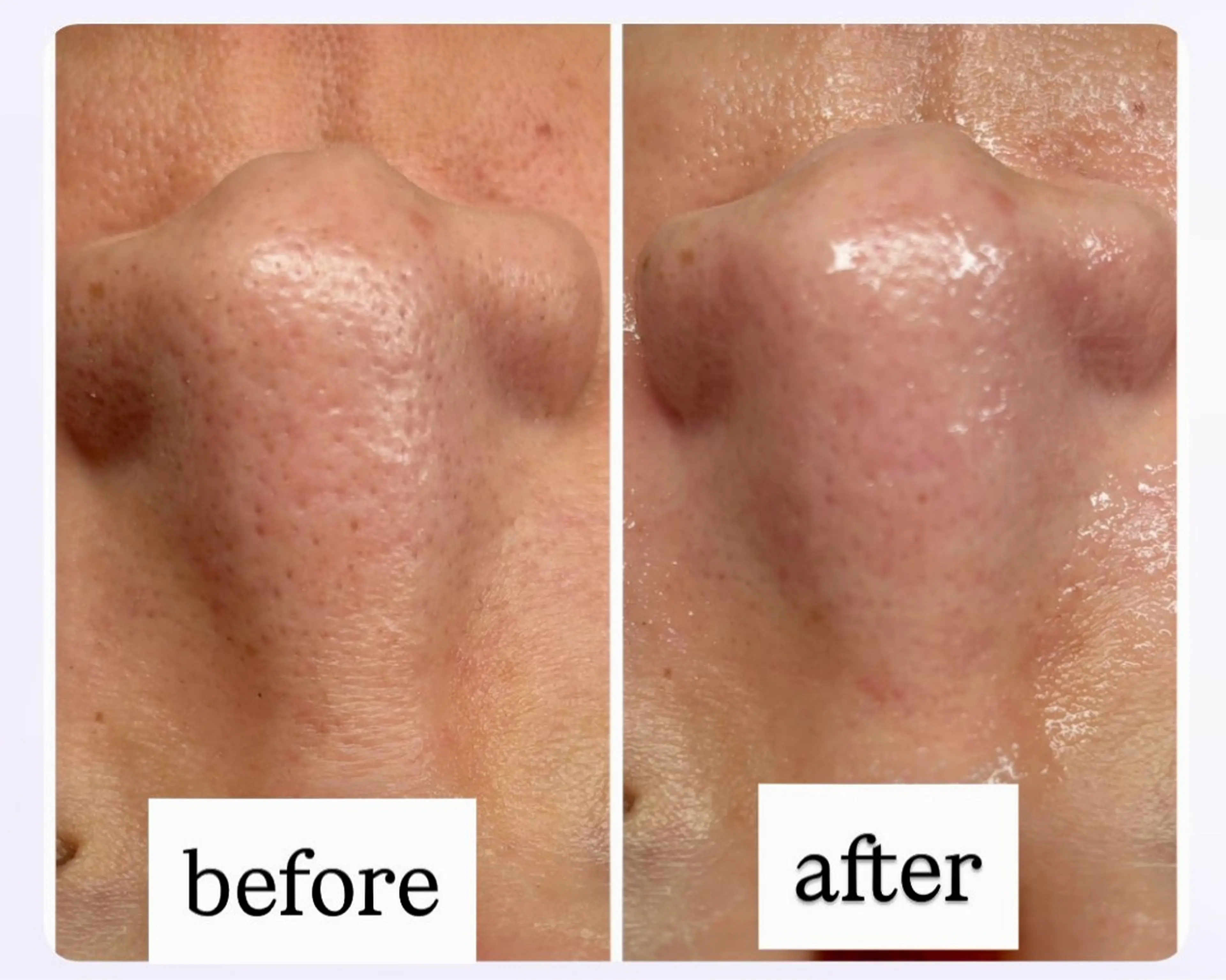 その他 Salon【yuzu.】所属・🍊肌管理×美眉 【yuzu.】の眉毛・アイブロウイメージ