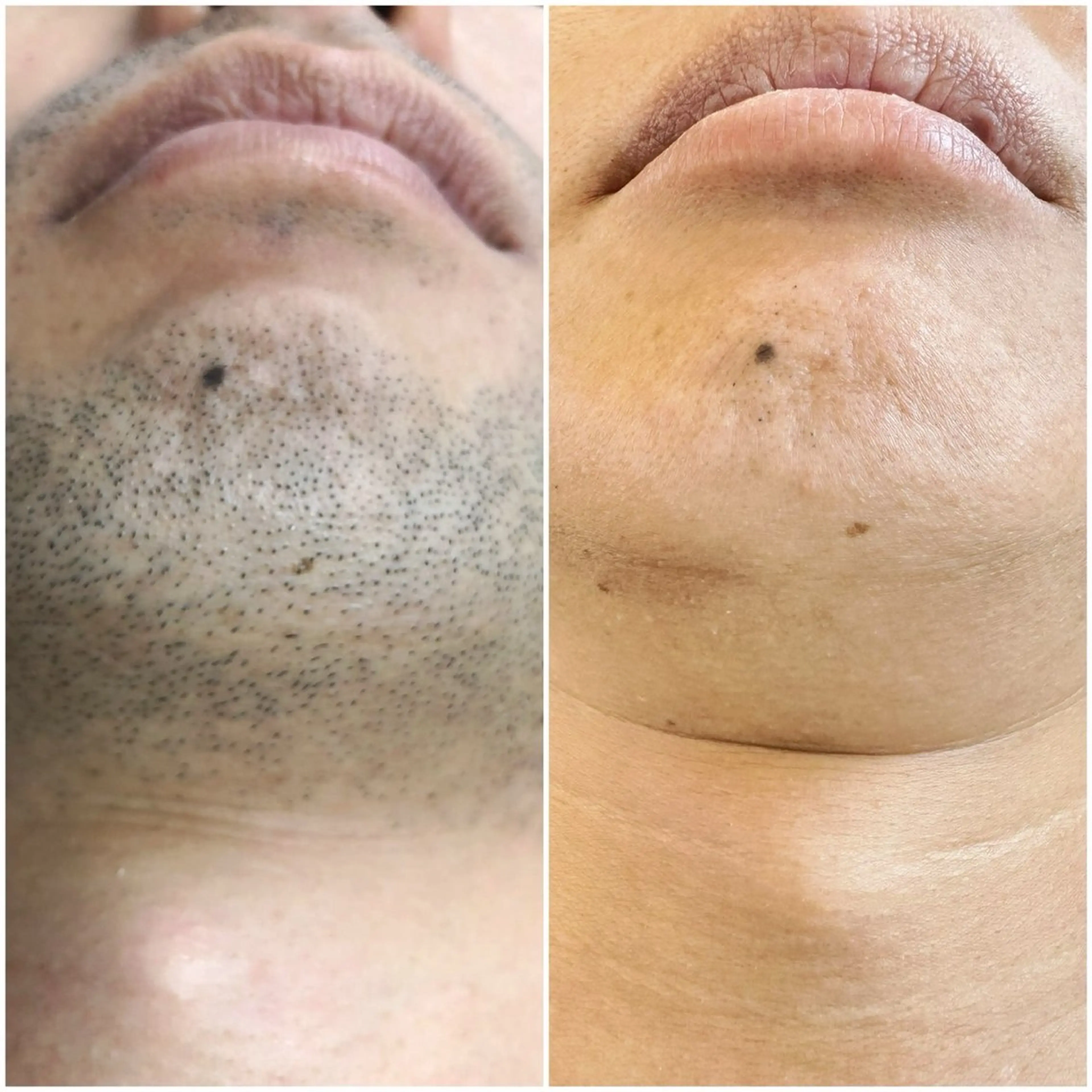 脱毛 脱毛専門サロンElixir加須店所属・脱毛専門サロン Elixir　加須店のエステ・リラクイメージ