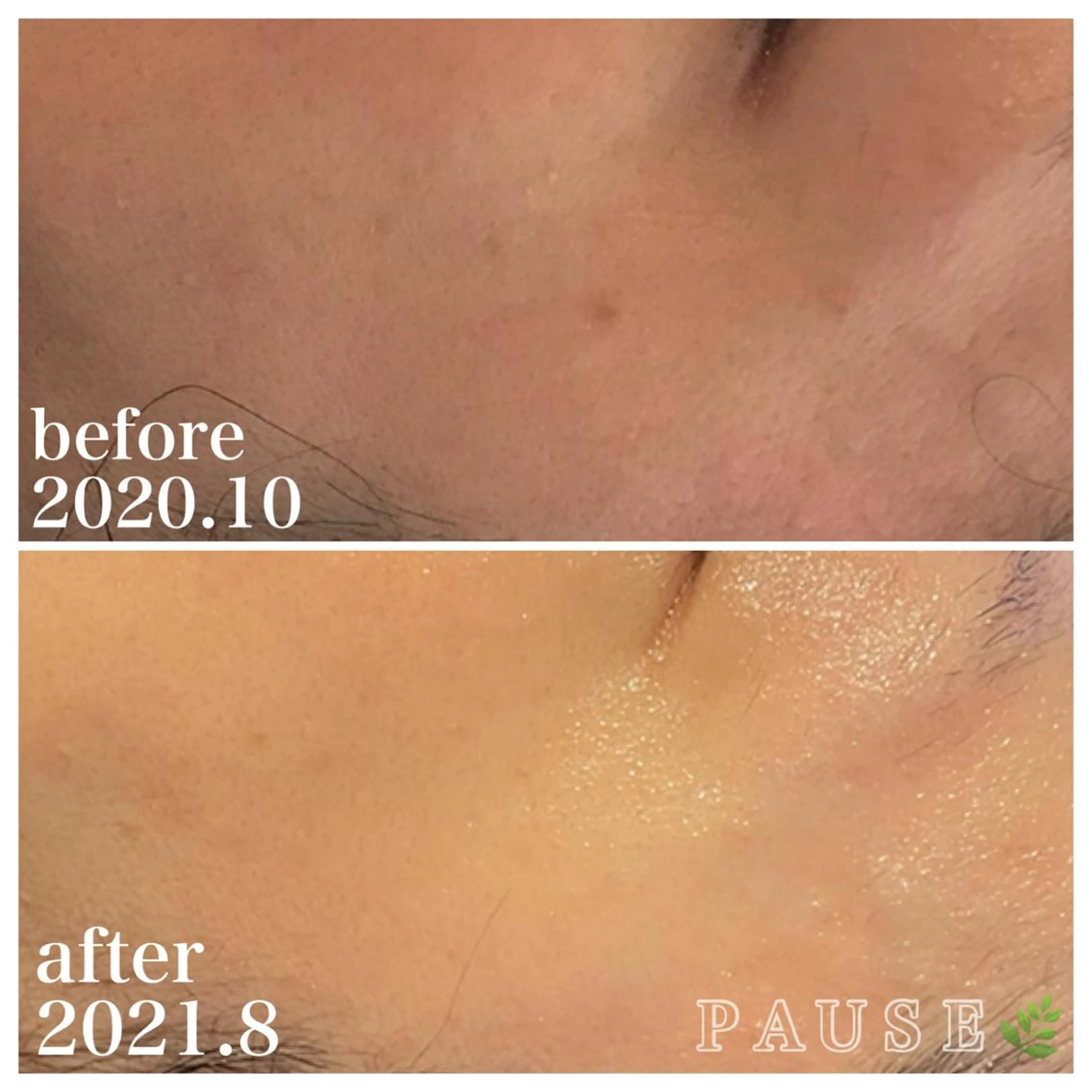 エステ 浜野 恵美のエステ・リラクイメージ