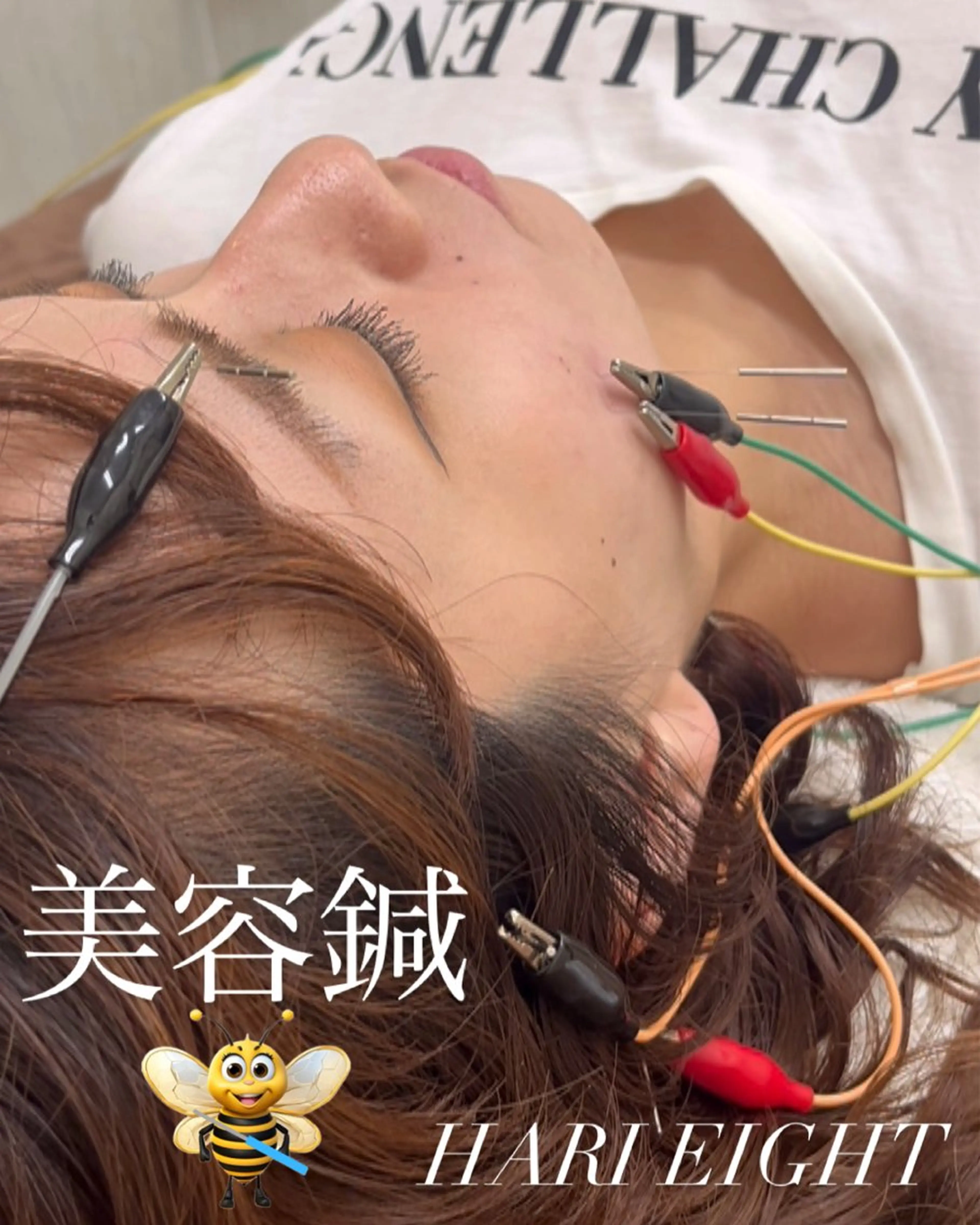 はりエイト所属・鍼灸院 はりエイトのエステ・リラクイメージ