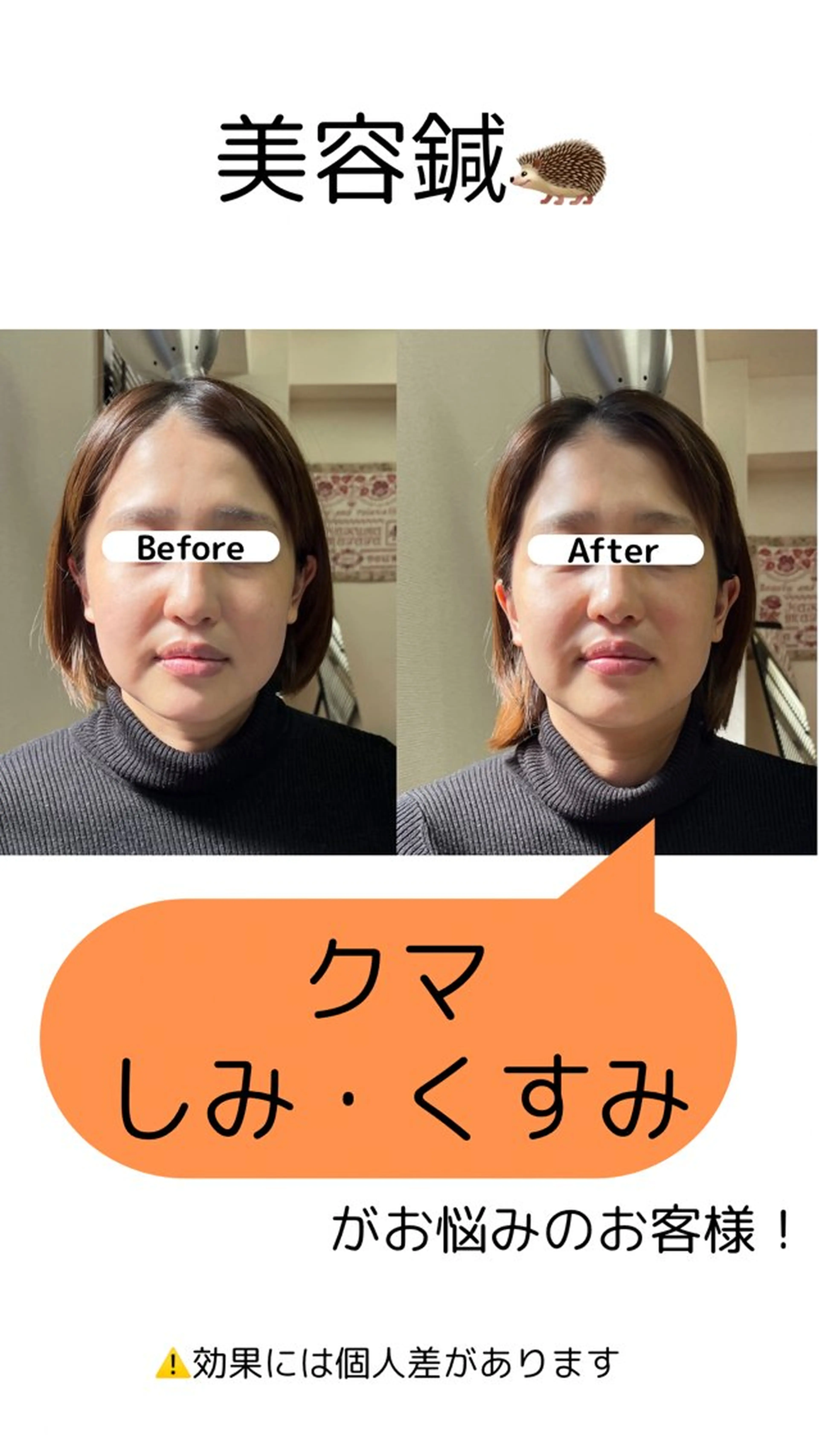 出張鍼灸師 miyuのエステ・リラクイメージ