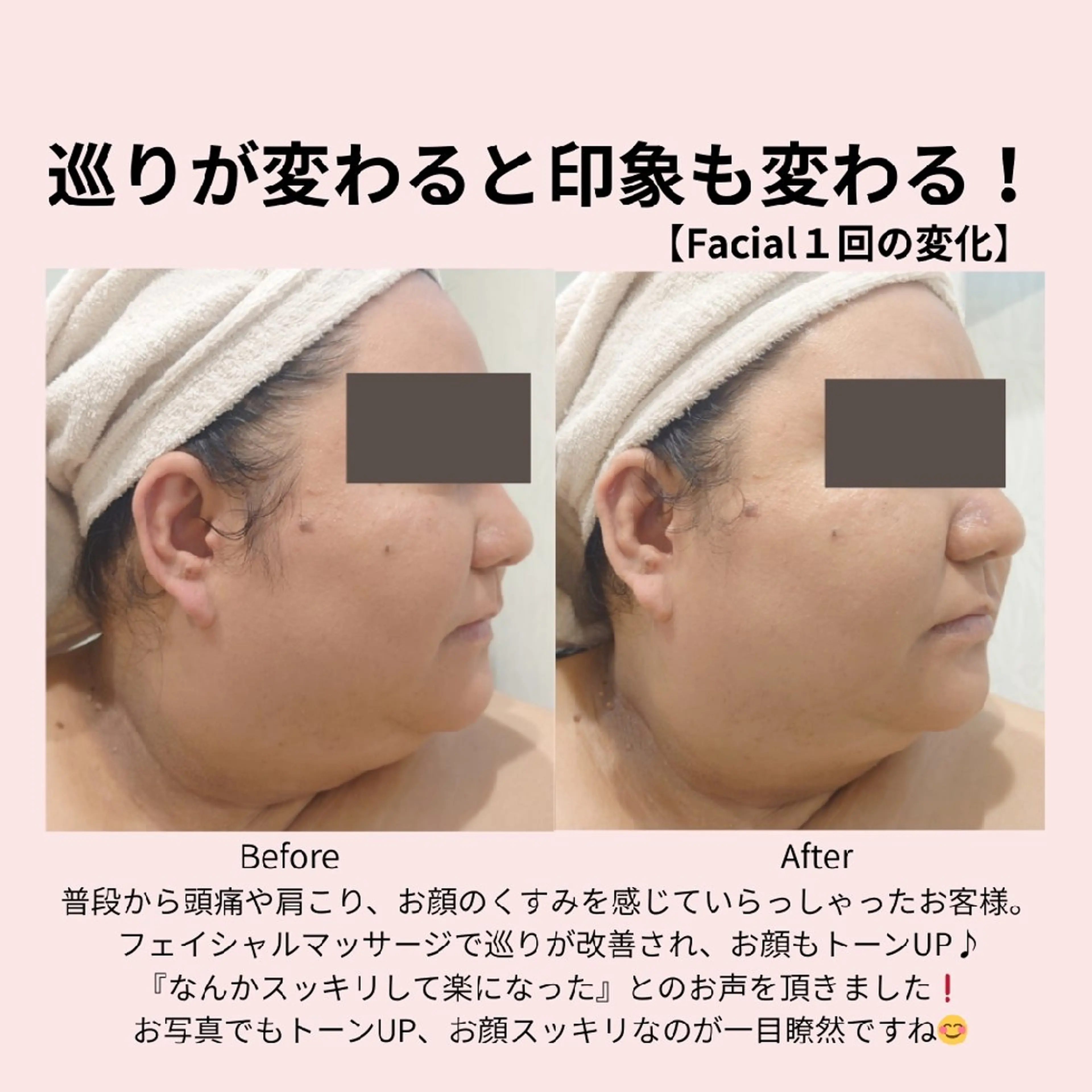 エステ PRETTIEST SHINE所属・フェイシャル/ボディ /ブライダル山田浩子のエステ・リラクイメージ