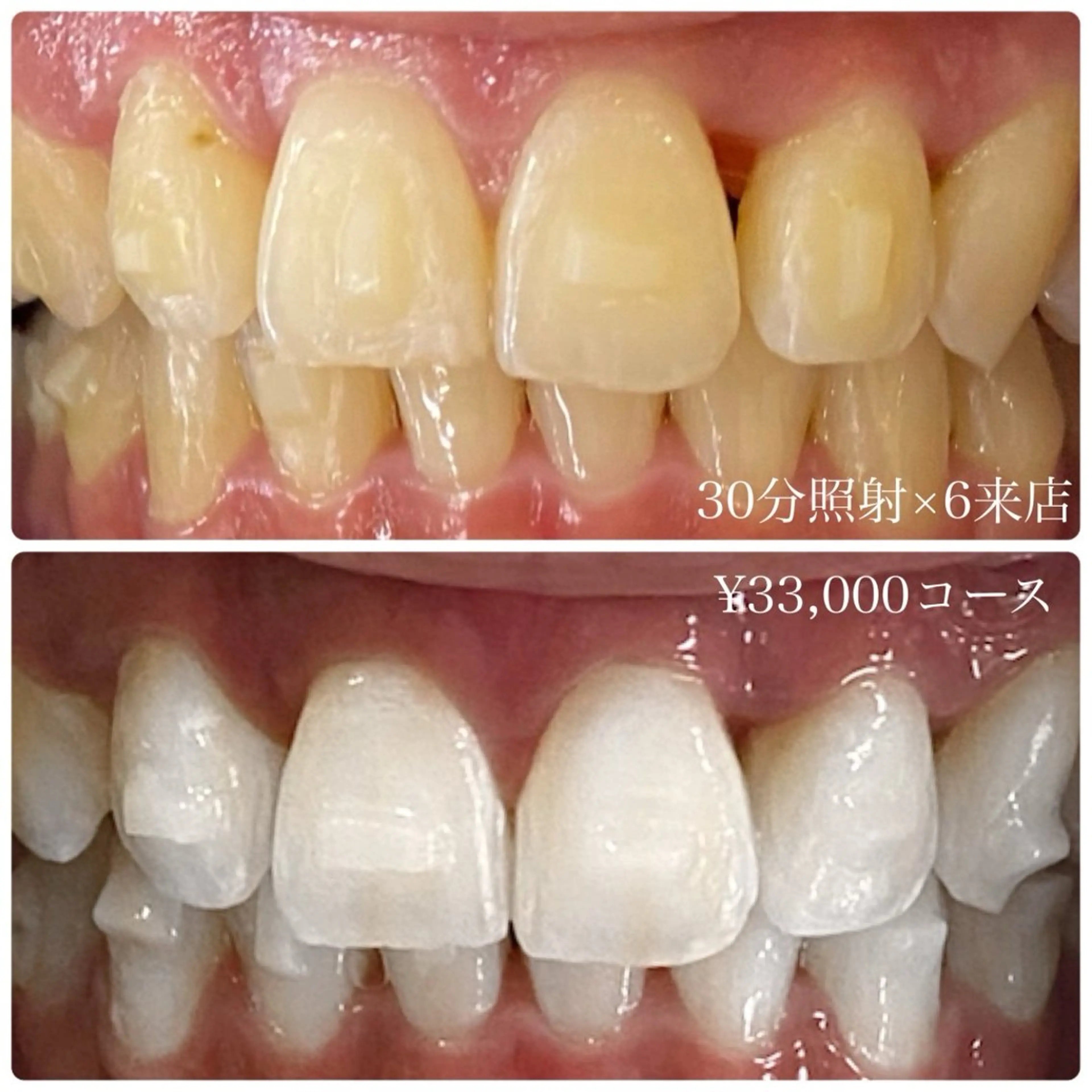 PLATINUM Beauty 横浜店所属・ホワイトニングルーム 横浜店のその他イメージ