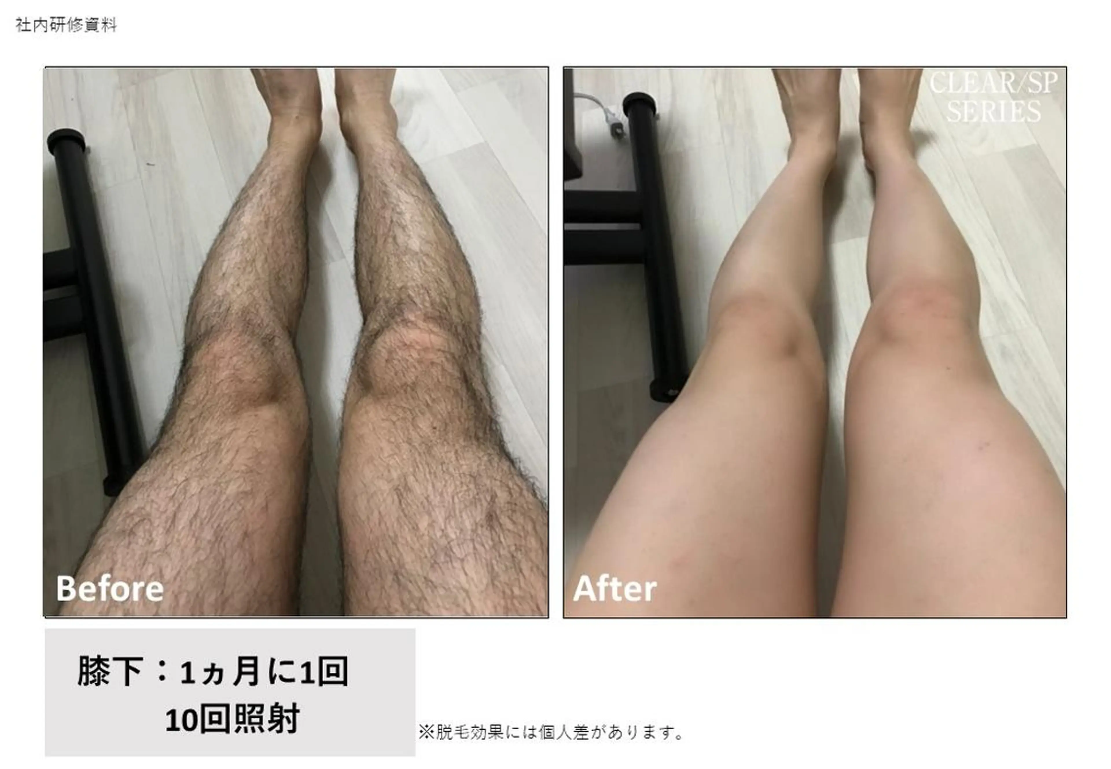 メンズ 脱毛 トータルクリア 田岡のエステ・リラクイメージ