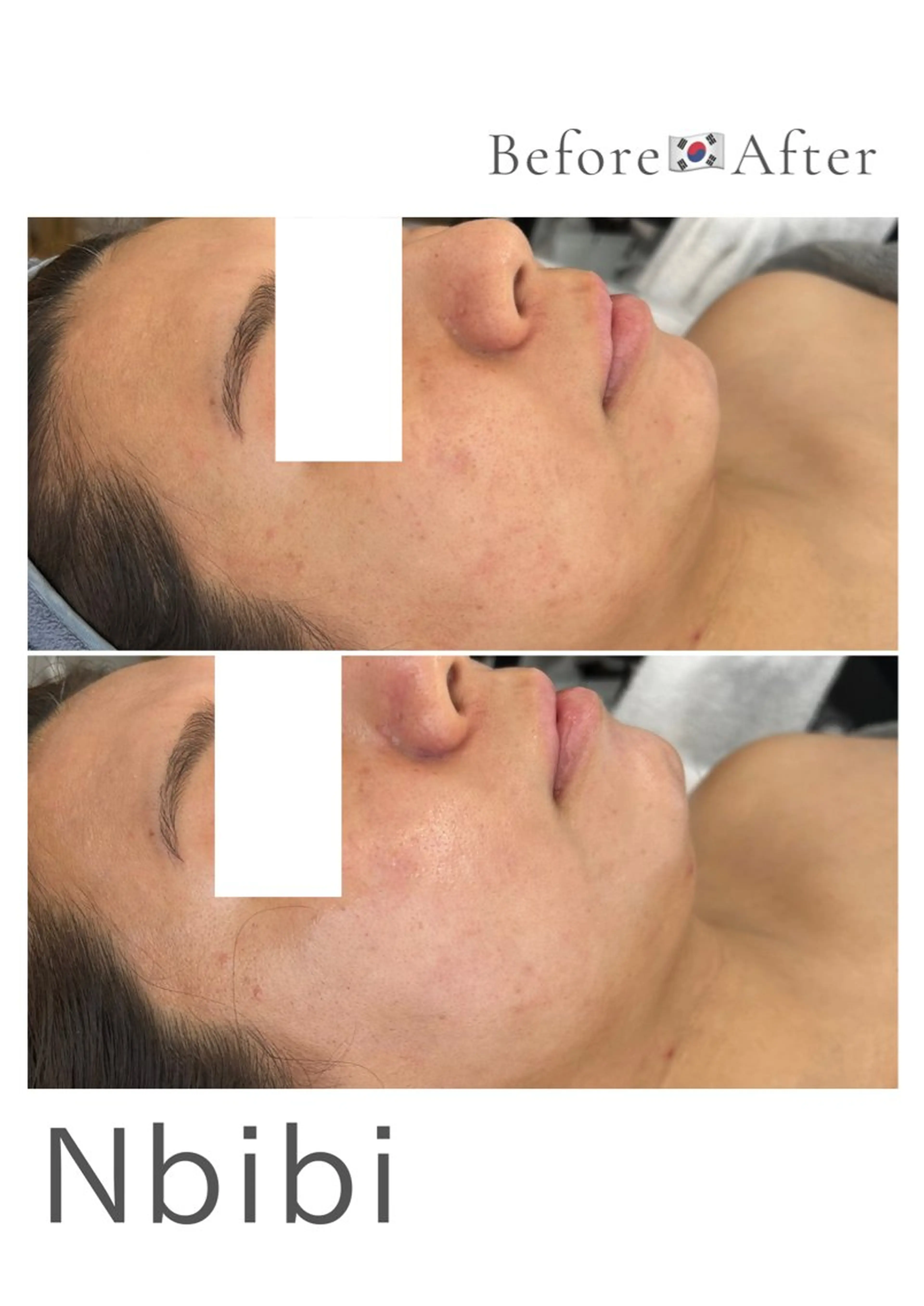 韓国🇰🇷価格 サロン_Nbibiのエステ・リラクイメージ