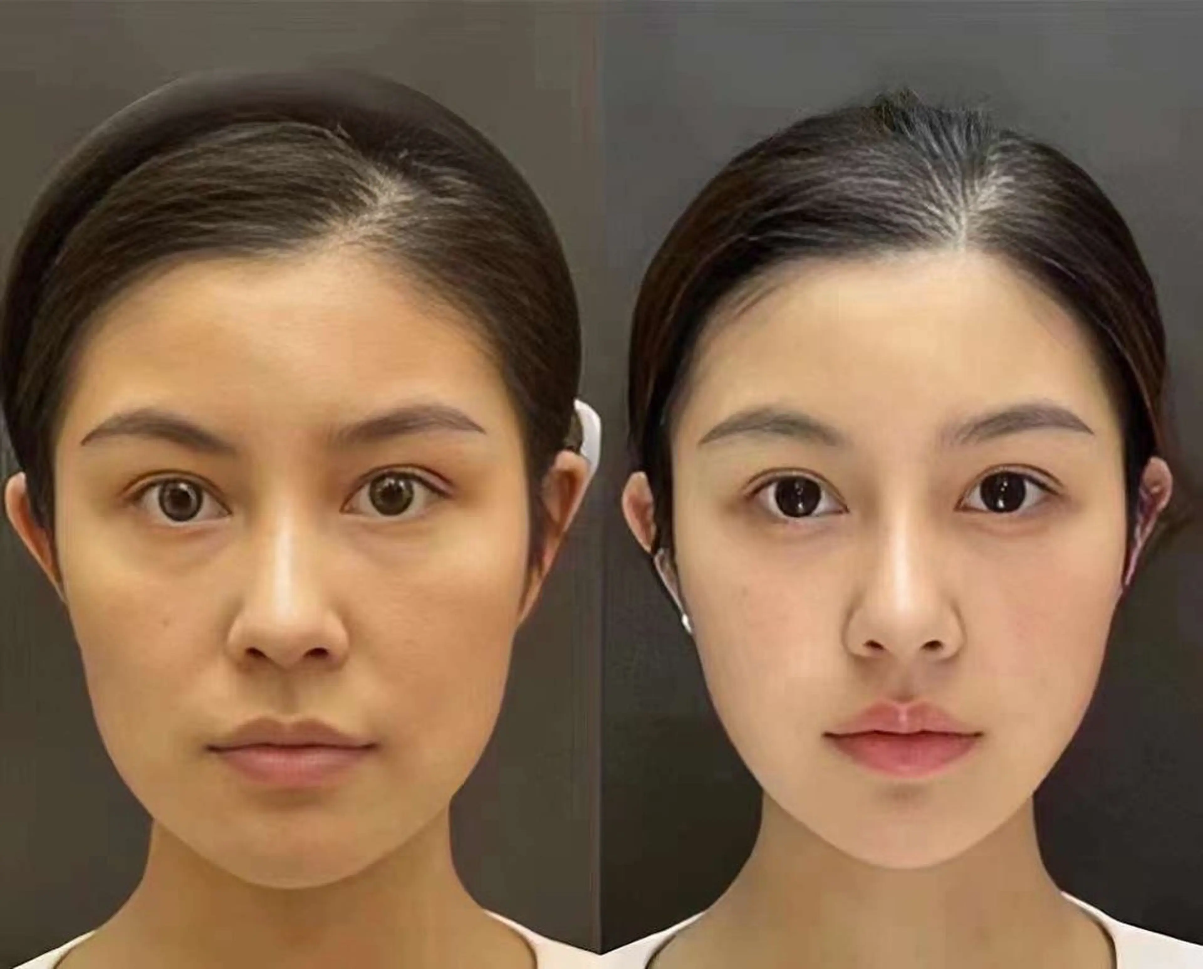 マツエク・マツパ エステ aliaハイフ&水光ジェットサロン所属・aliaハーブ水光店 エステティシャン募集のエステ・リラクイメージ