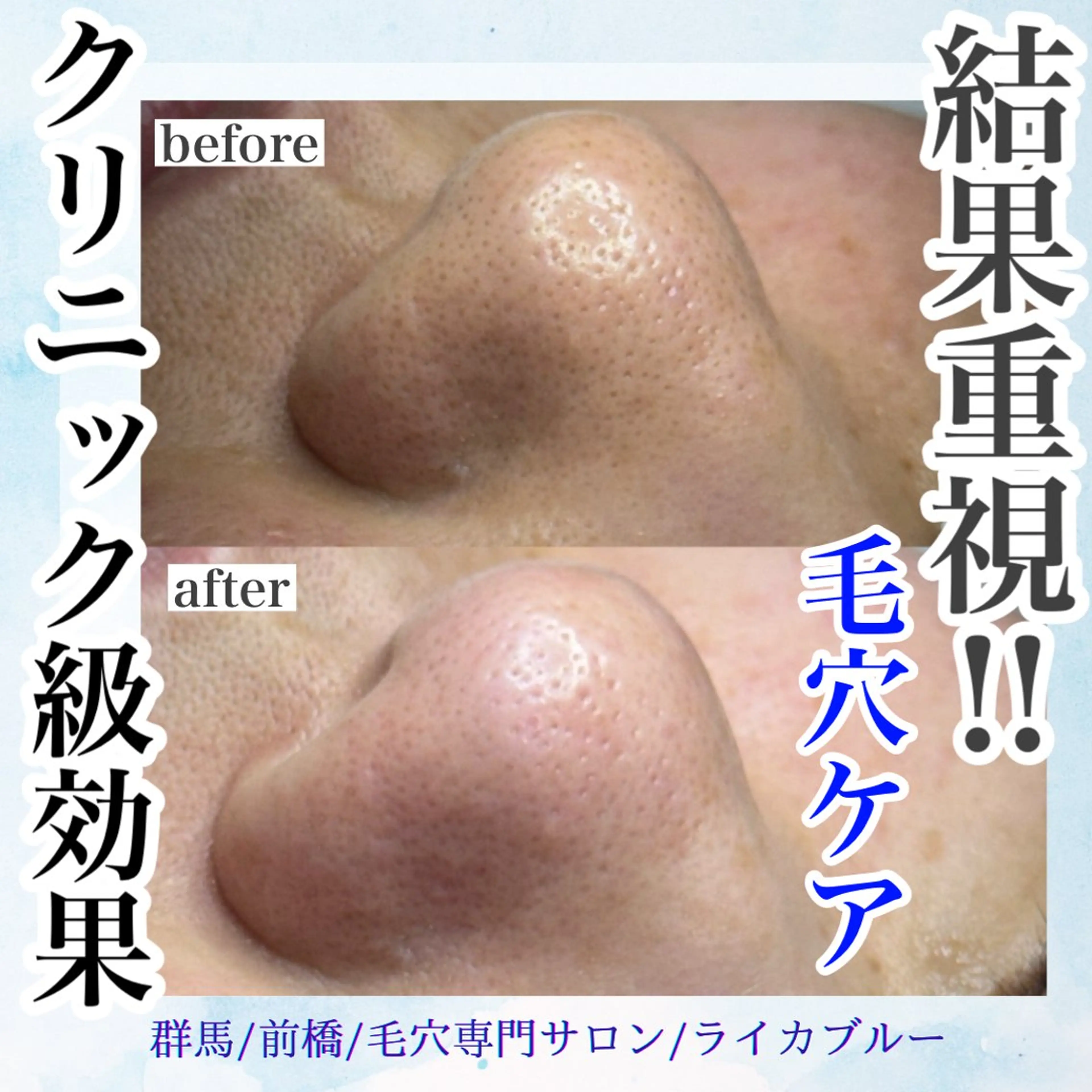 毛穴専門サロン ライカブルーのエステ・リラクイメージ