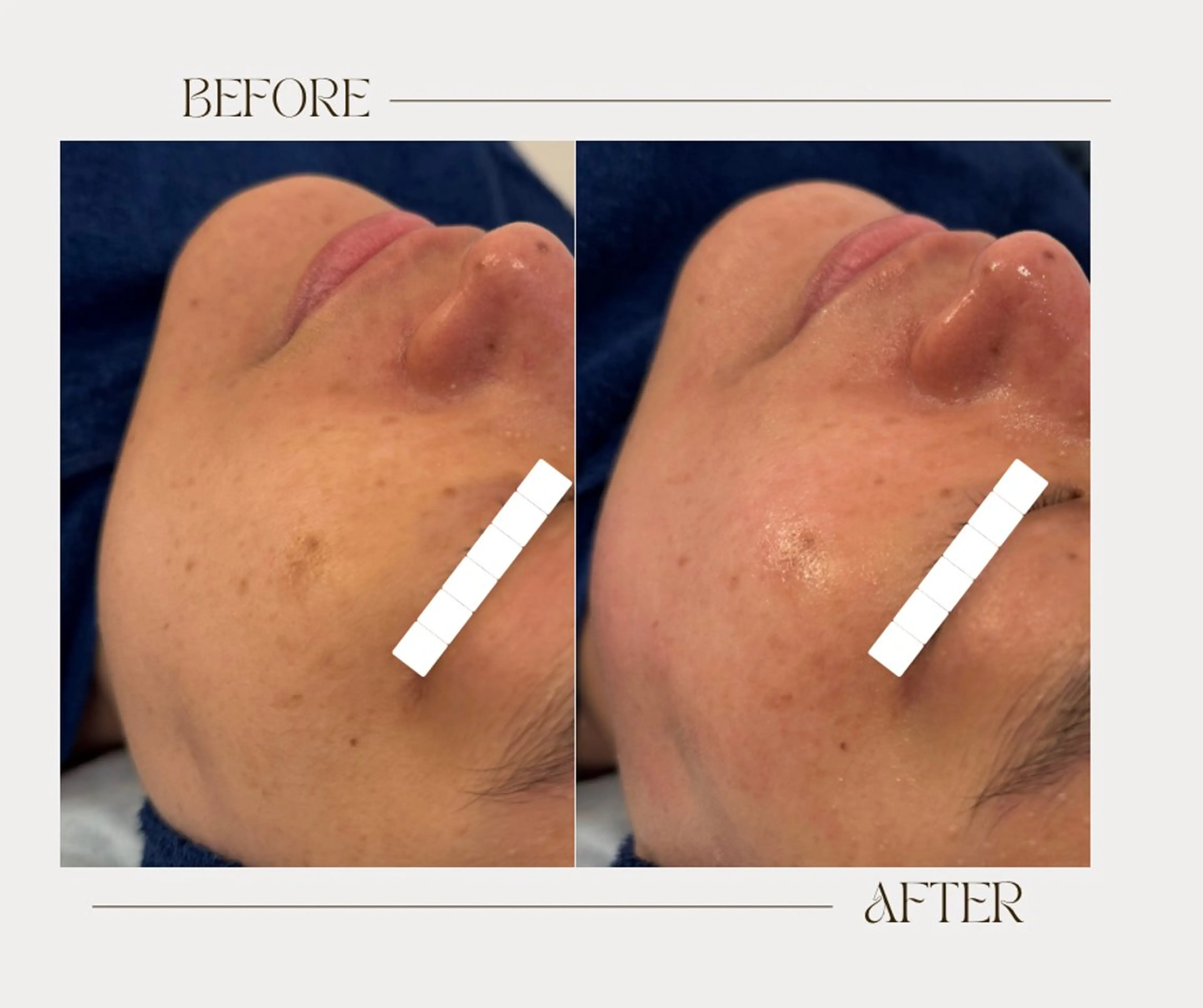 エステ 艶肌ワックス ALLY.のエステ・リラクイメージ