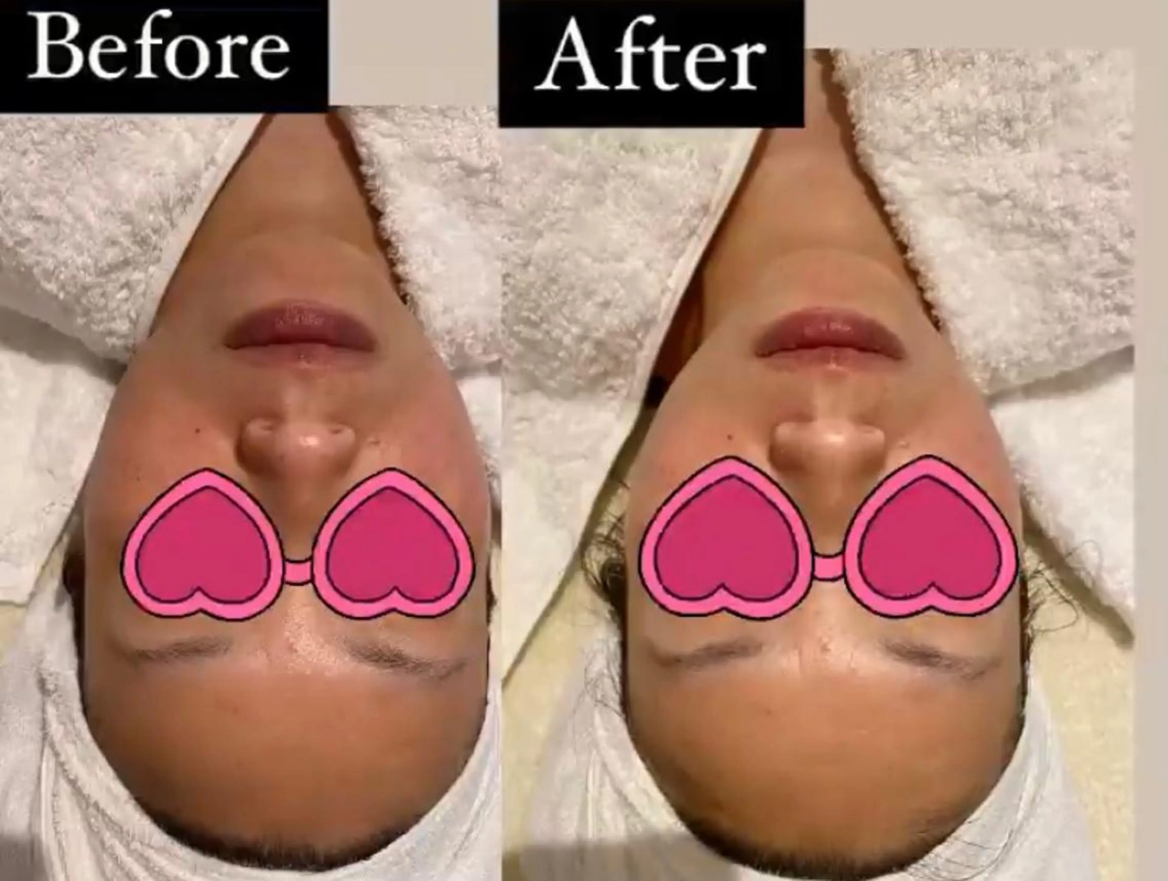 エステ リラク MENARD BLOOMのエステ・リラクイメージ