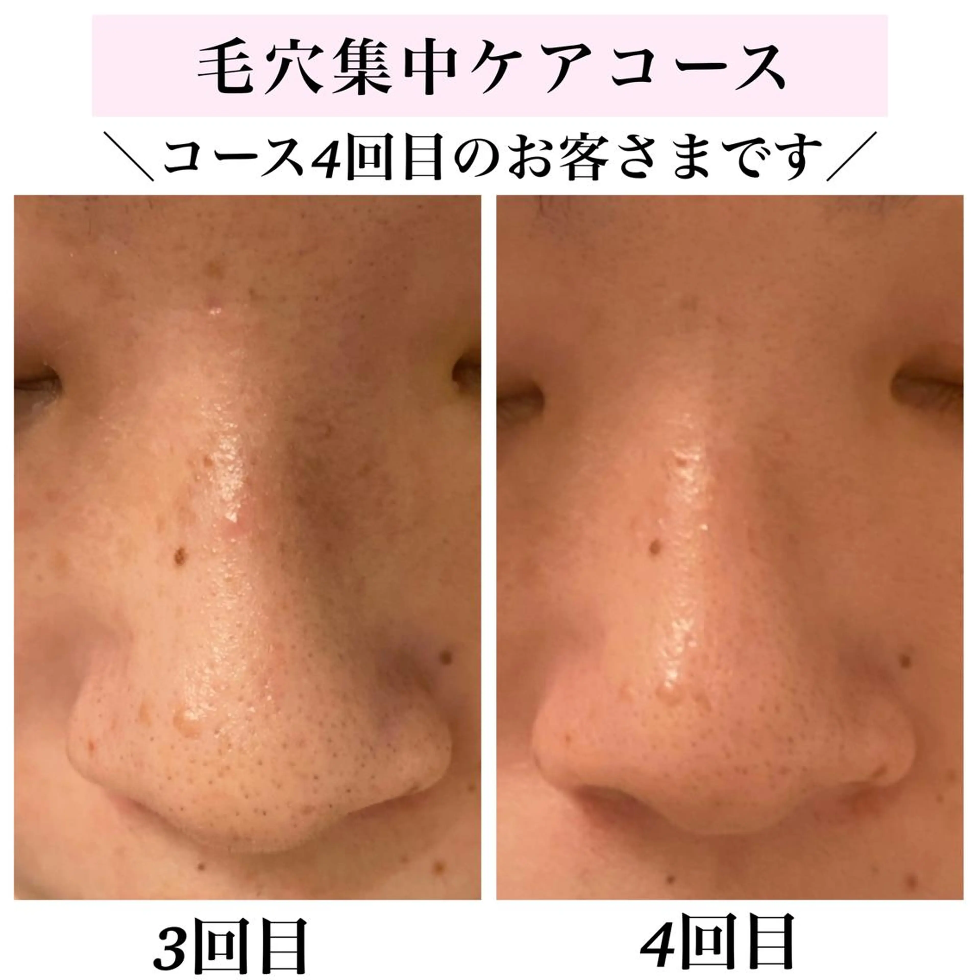 エステ リラク Bellesthe (ベルエステ)のエステ・リラクイメージ