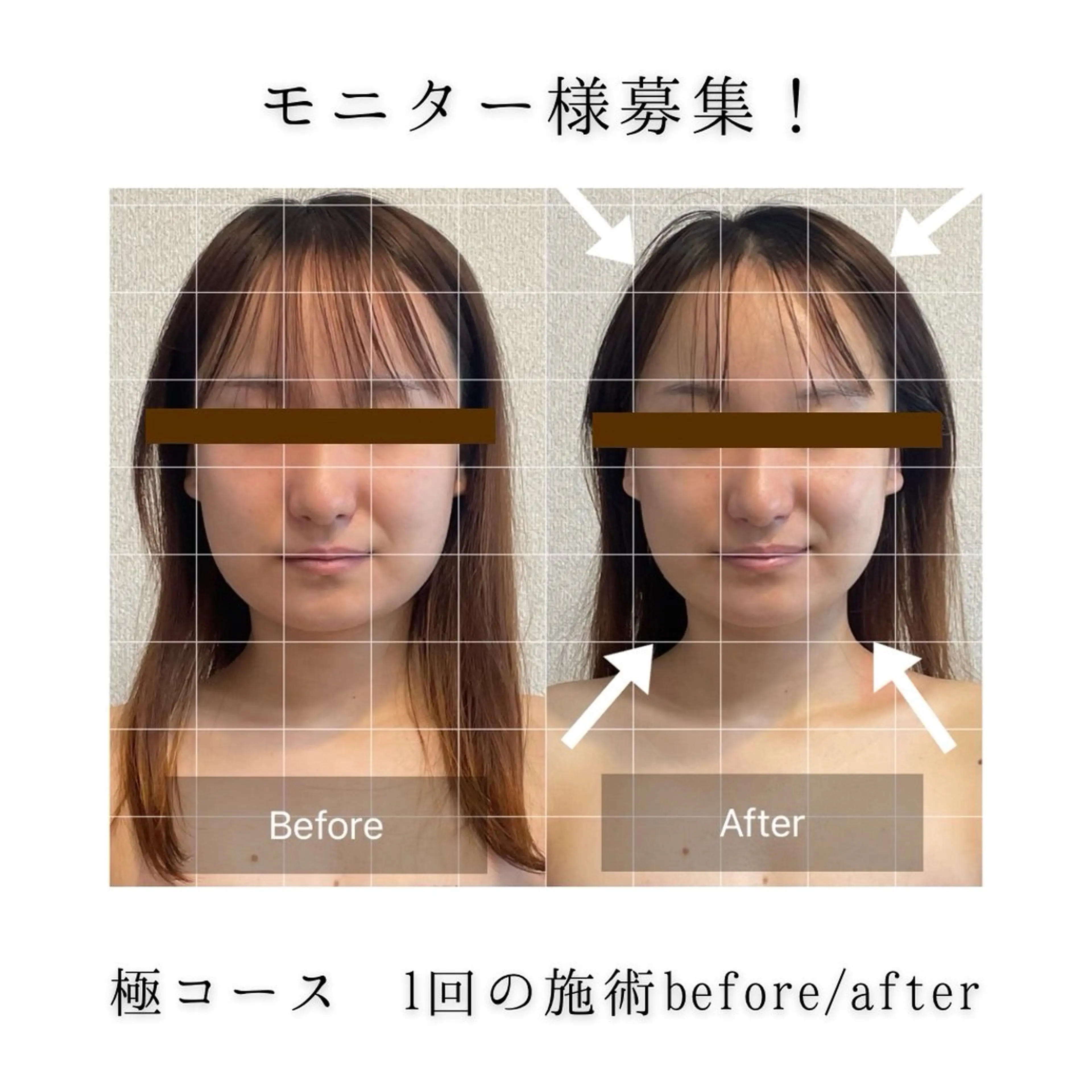 小顔集中型エステ 堺／大美野のエステ・リラクイメージ