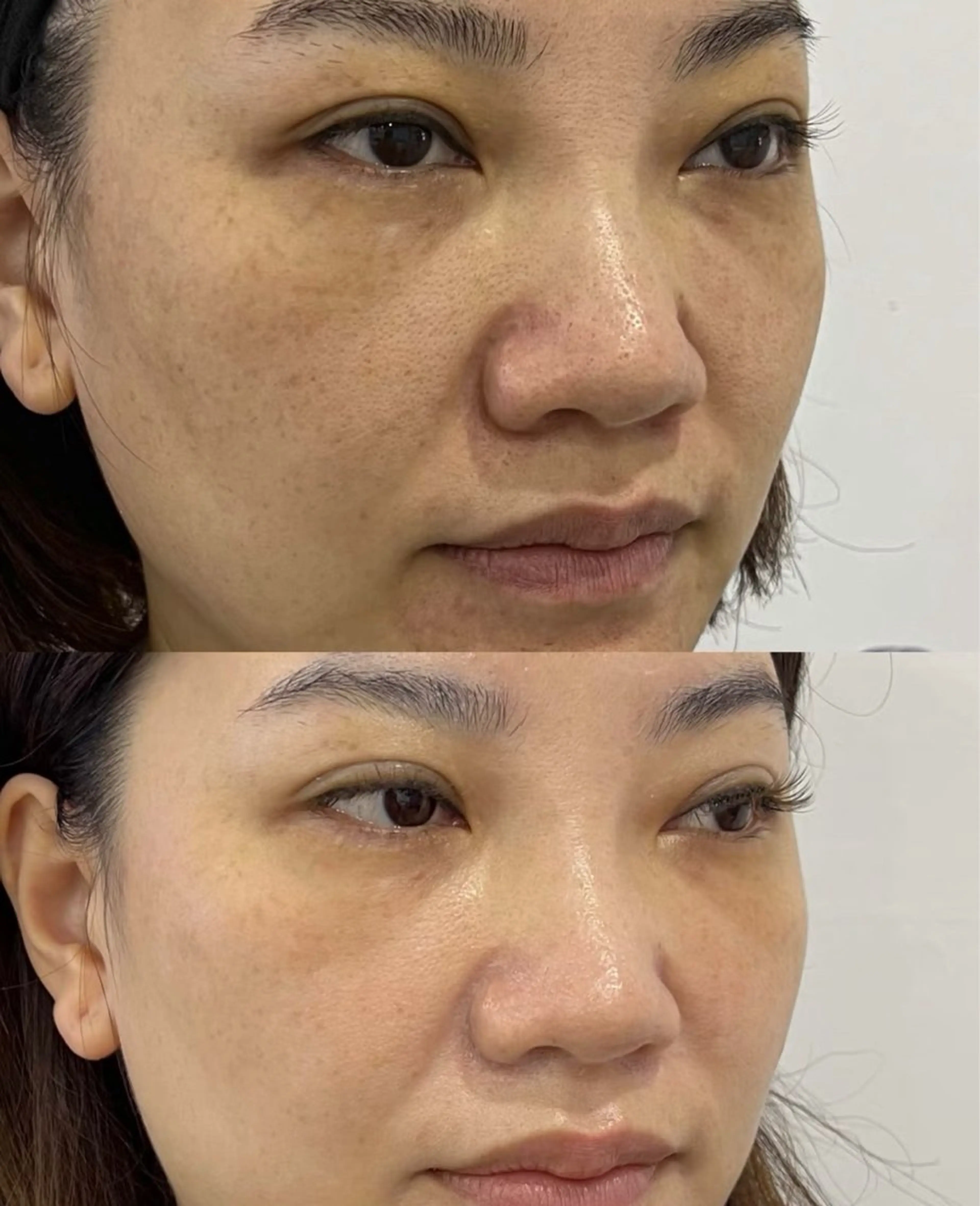 ネイル エステ aliaハイフ&水光ジェットサロン所属・aliaハーブ水光店 エステティシャン募集のエステ・リラクイメージ