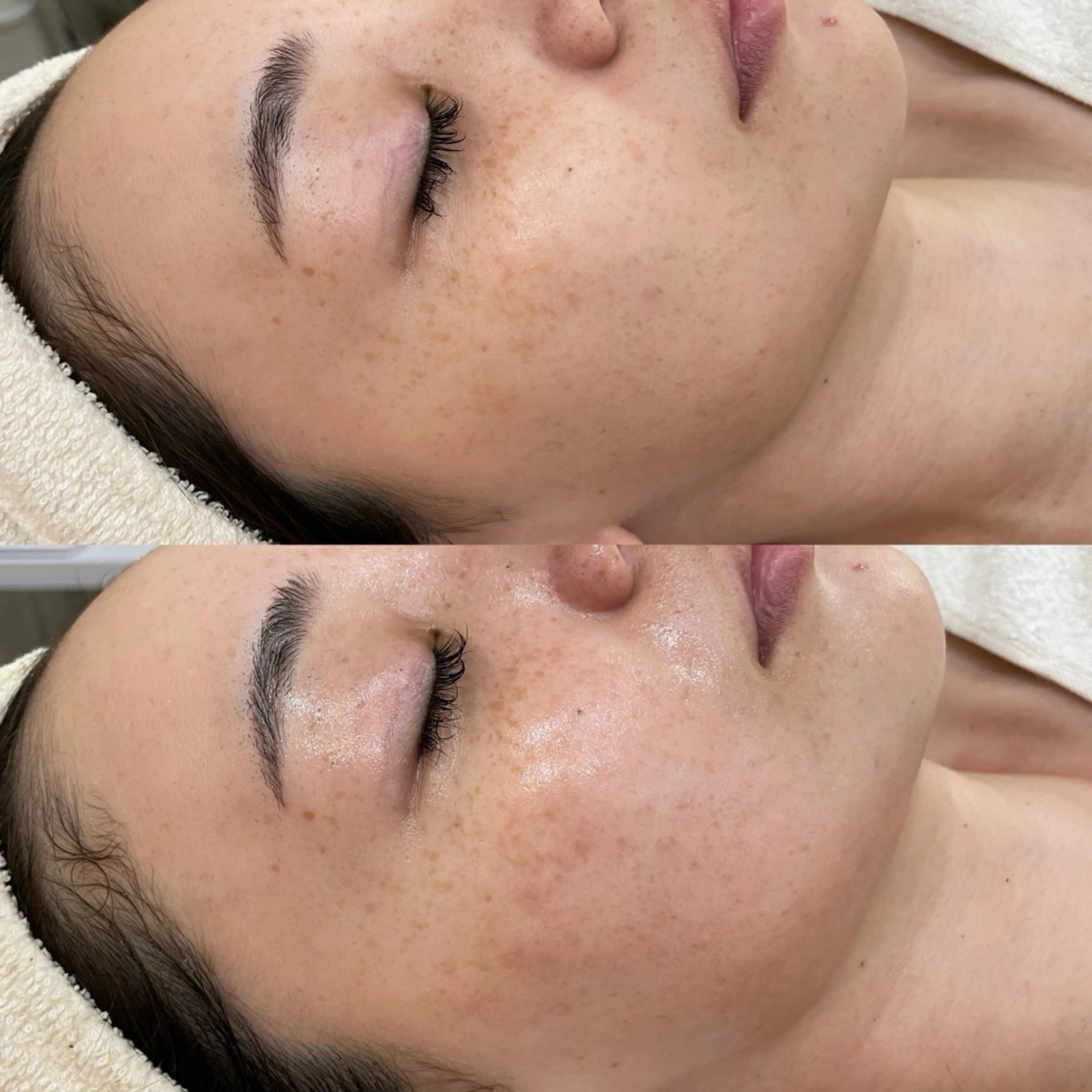 salon moi(モア)のエステ・リラクイメージ