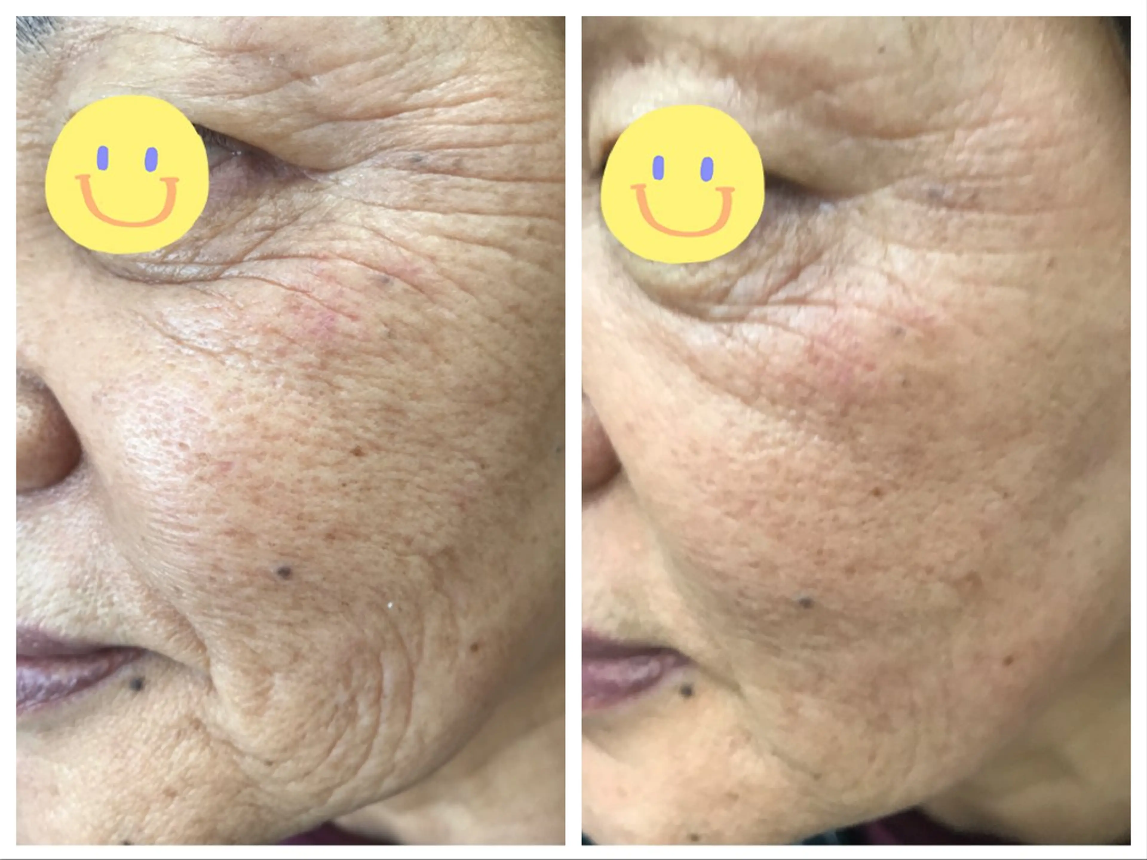 エステ エステセレニティー 山本美樹のエステ・リラクイメージ