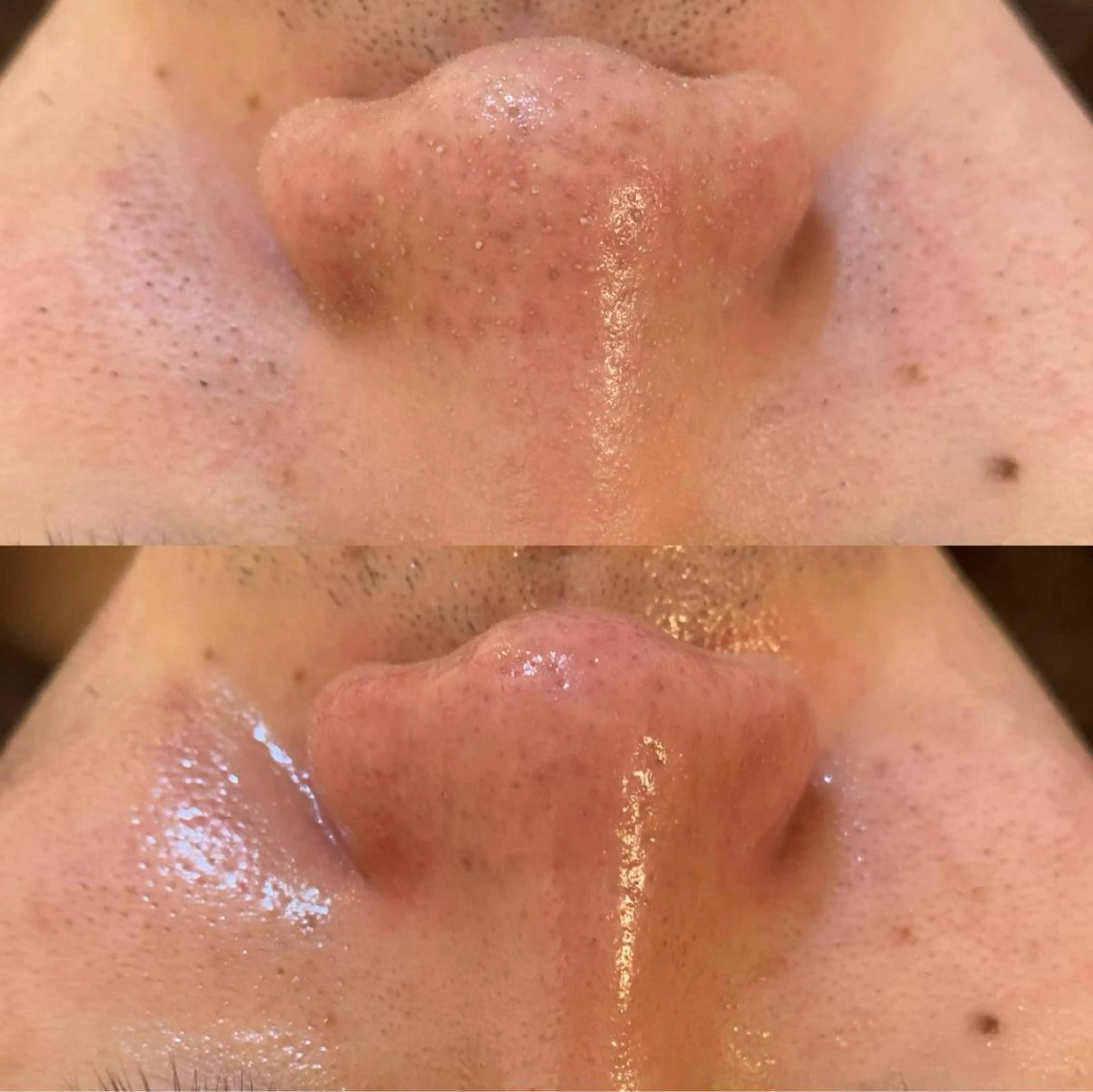 エステ リラク BELCIA福岡店　récolte de BELCIA（レコルトデベルシア）所属・BELCIA福岡店 レコルトデベルシアのエステ・リラクイメージ