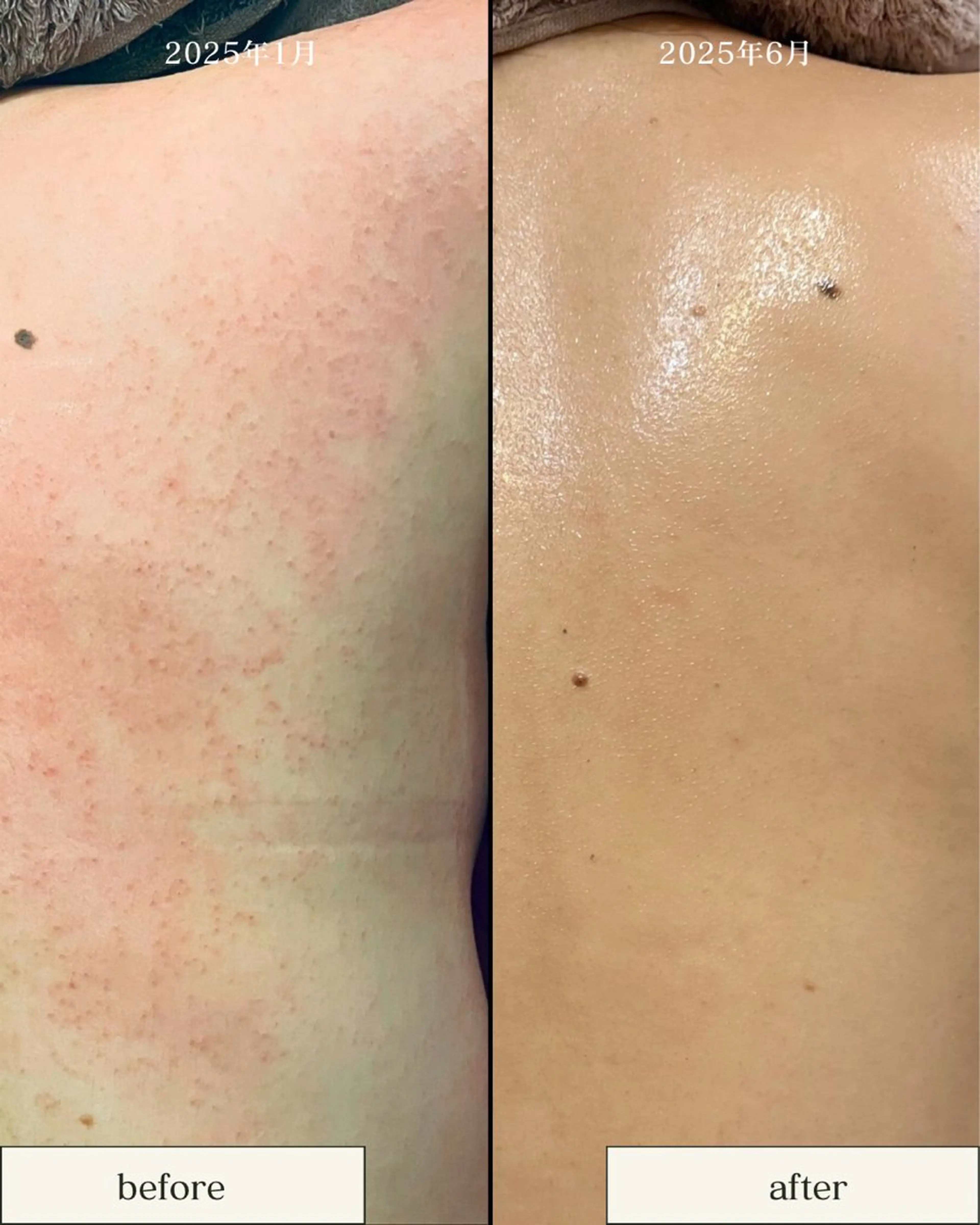 エステ サロンド エルのエステ・リラクイメージ