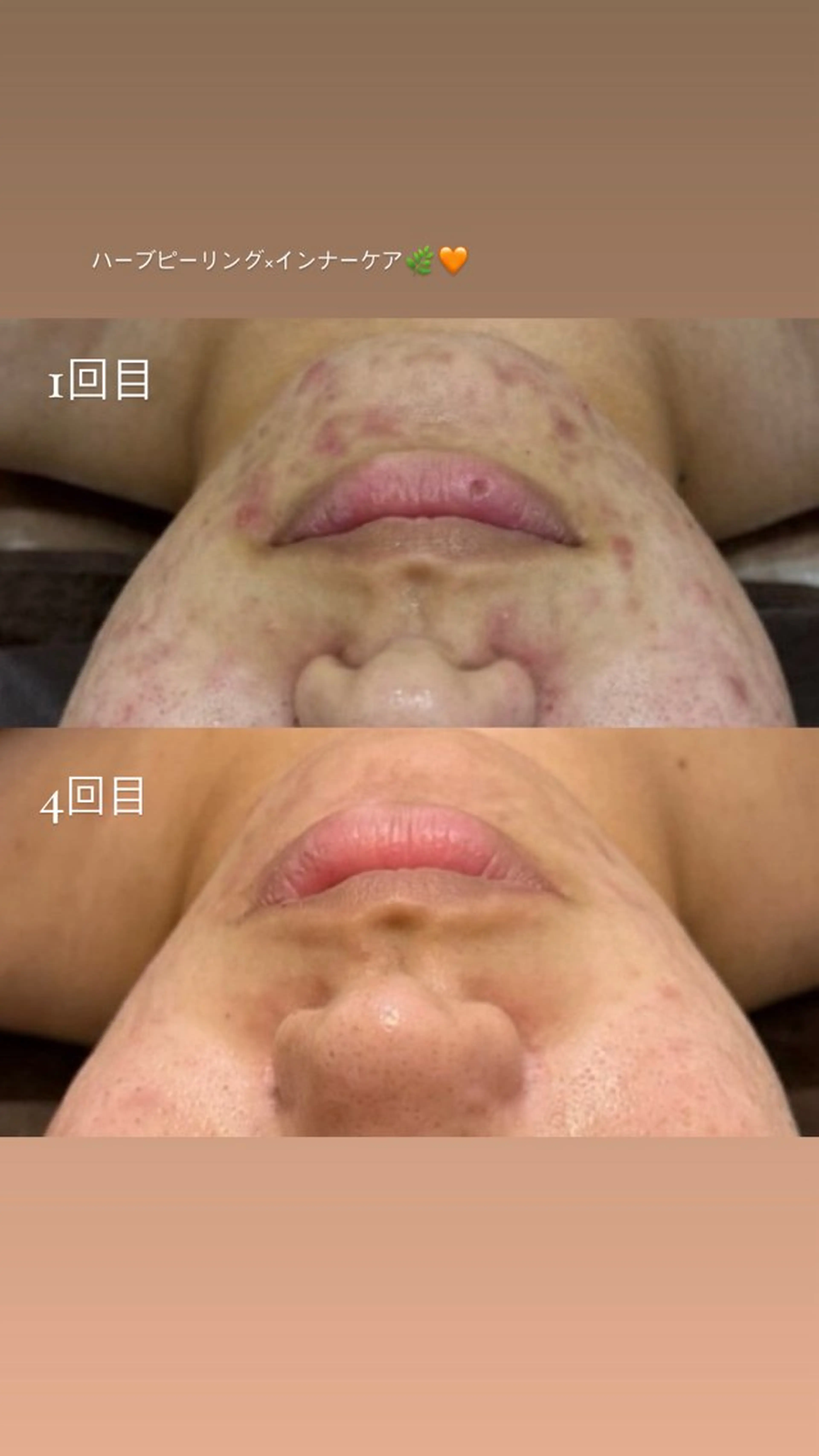 その他 Nicore所属・肌質改善🌿まつ毛 chapiのその他イメージ