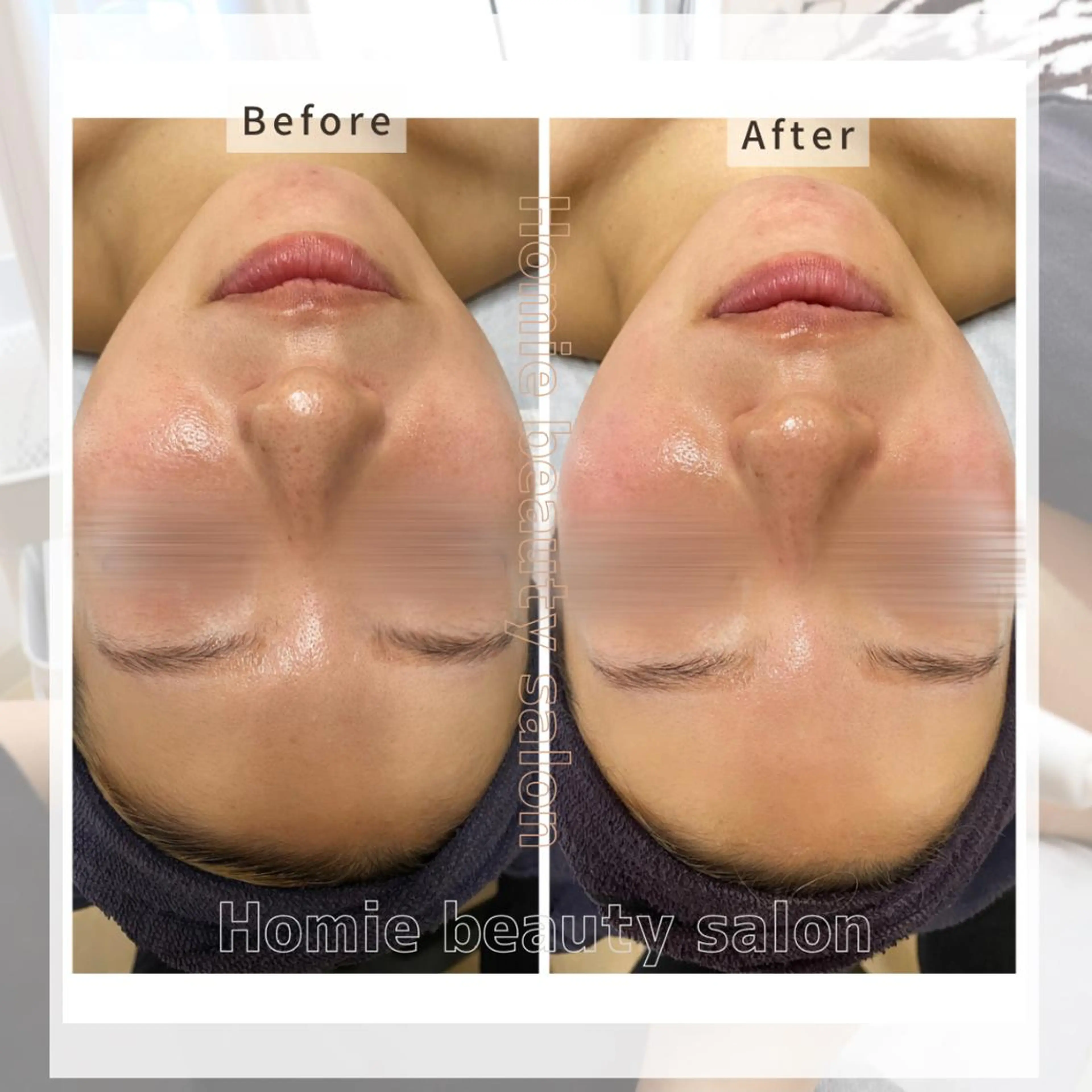 ハーブピーリング🌹 Homieのエステ・リラクイメージ