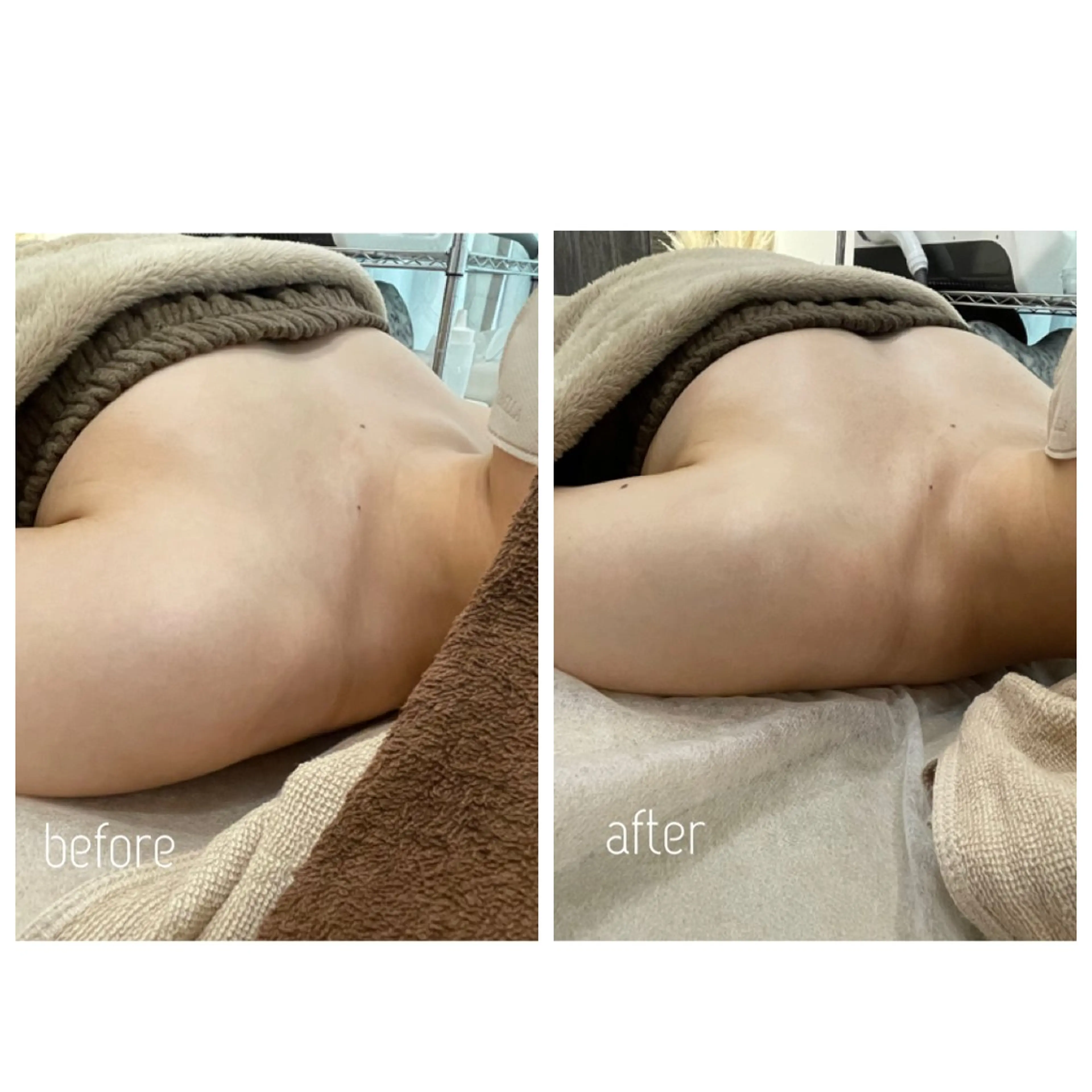 Rene 慢性疲労ケアサロンのエステ・リラクイメージ