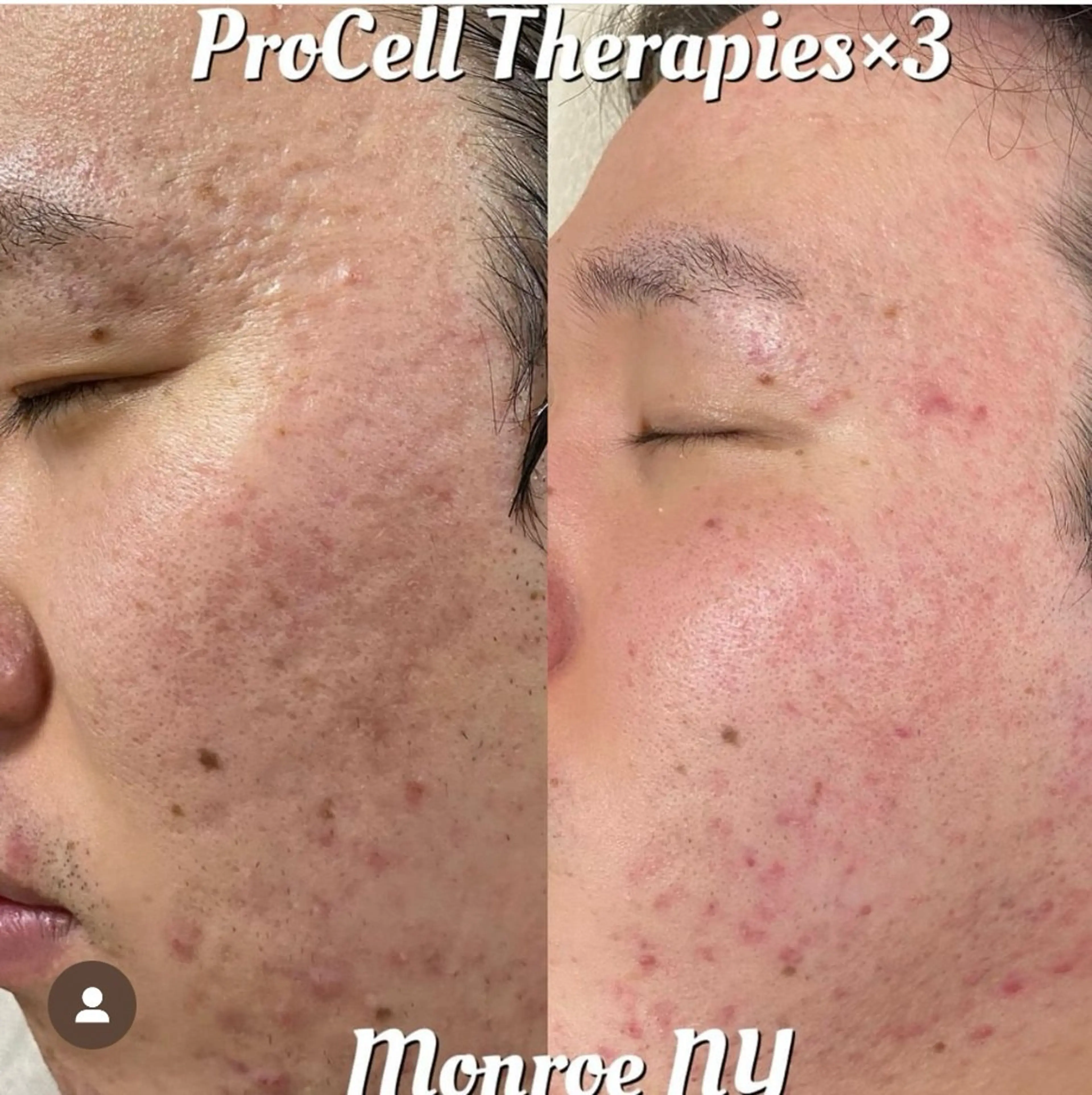 Blooming所属・LOUISE. ／肌質・頭皮のエステ・リラクイメージ