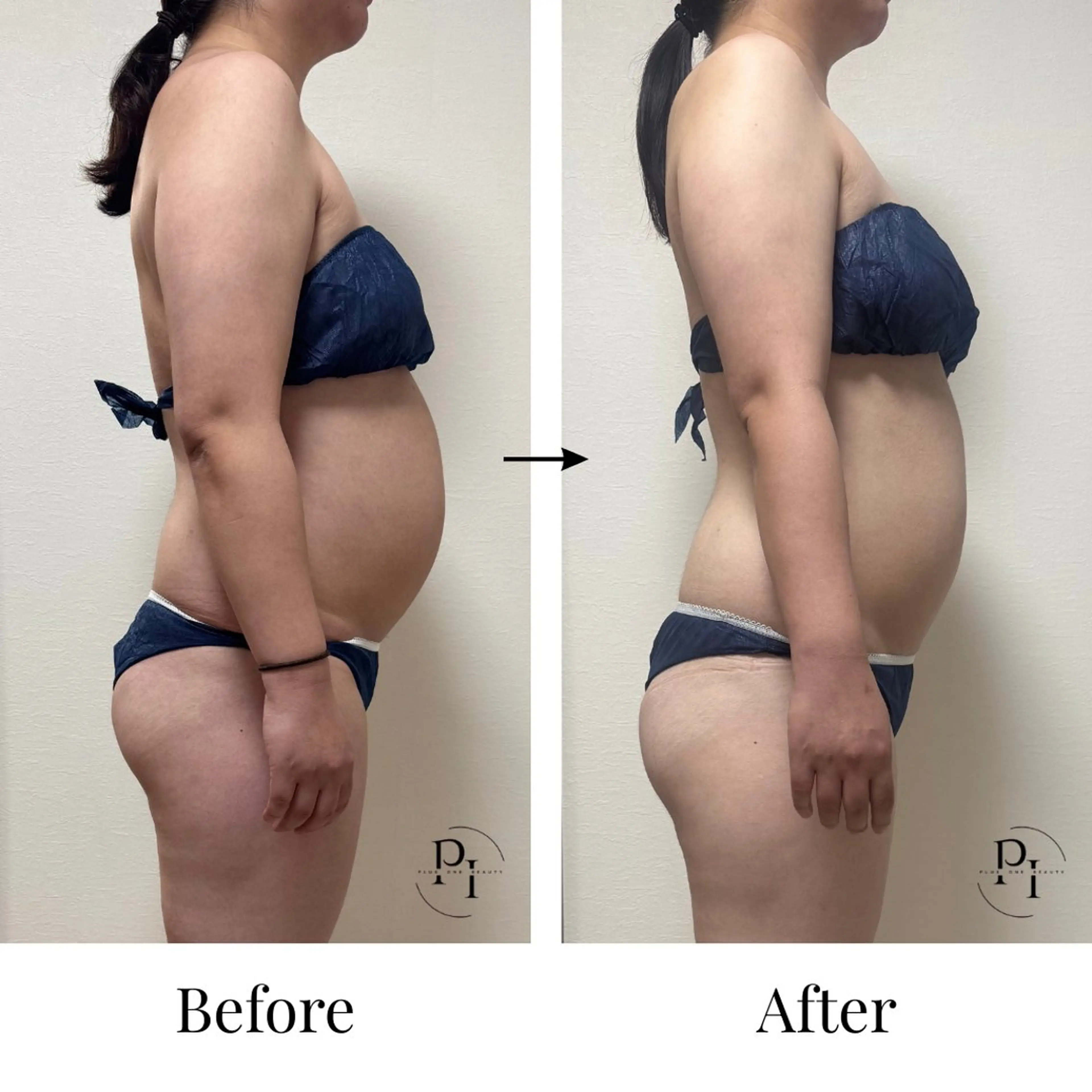 Plus One Beauty所属・【新大阪】痩身/小顔 美肌フェイシャルのエステ・リラクイメージ