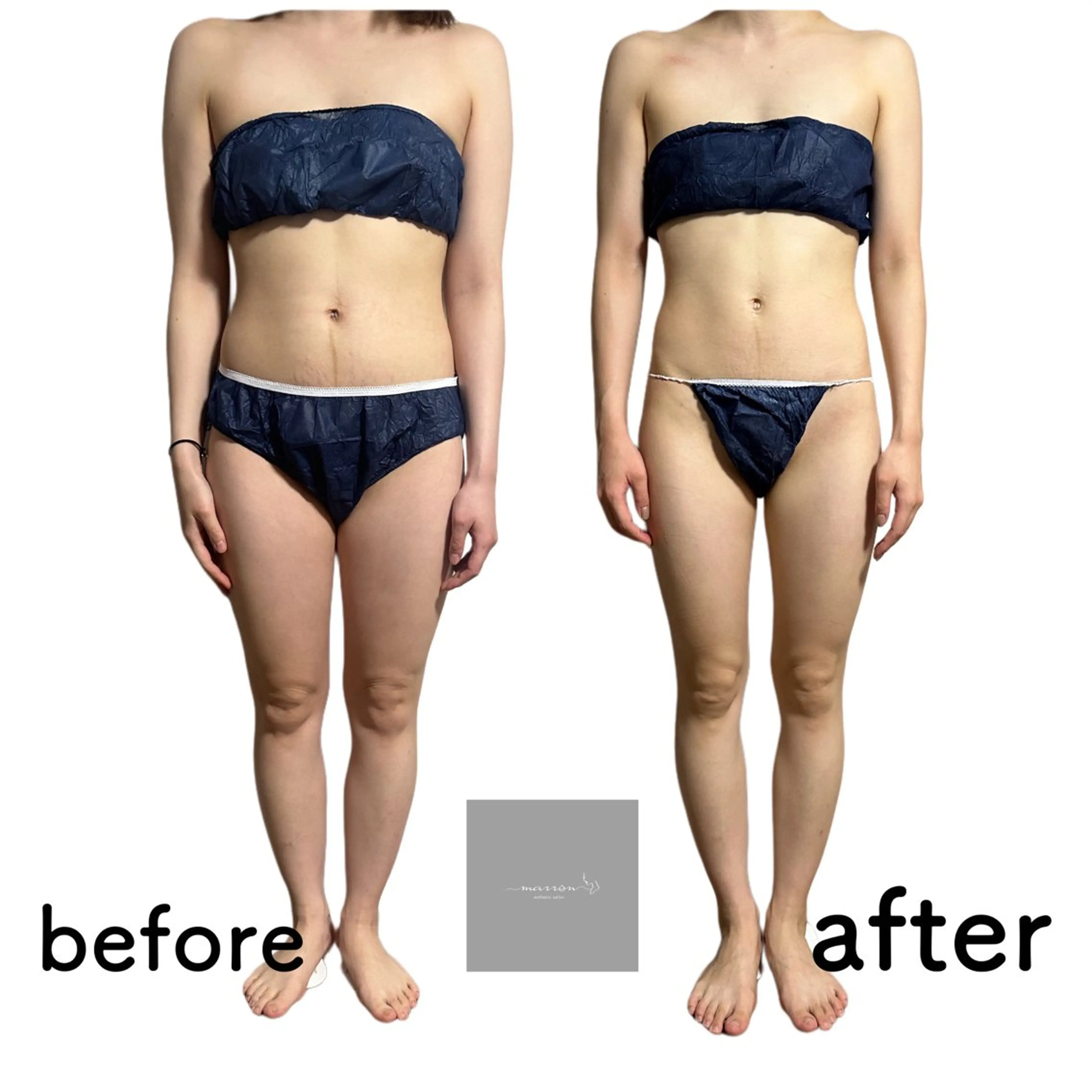 marron所属・痩身ハイパーナイフ ララピールリアボーテのエステ・リラクイメージ