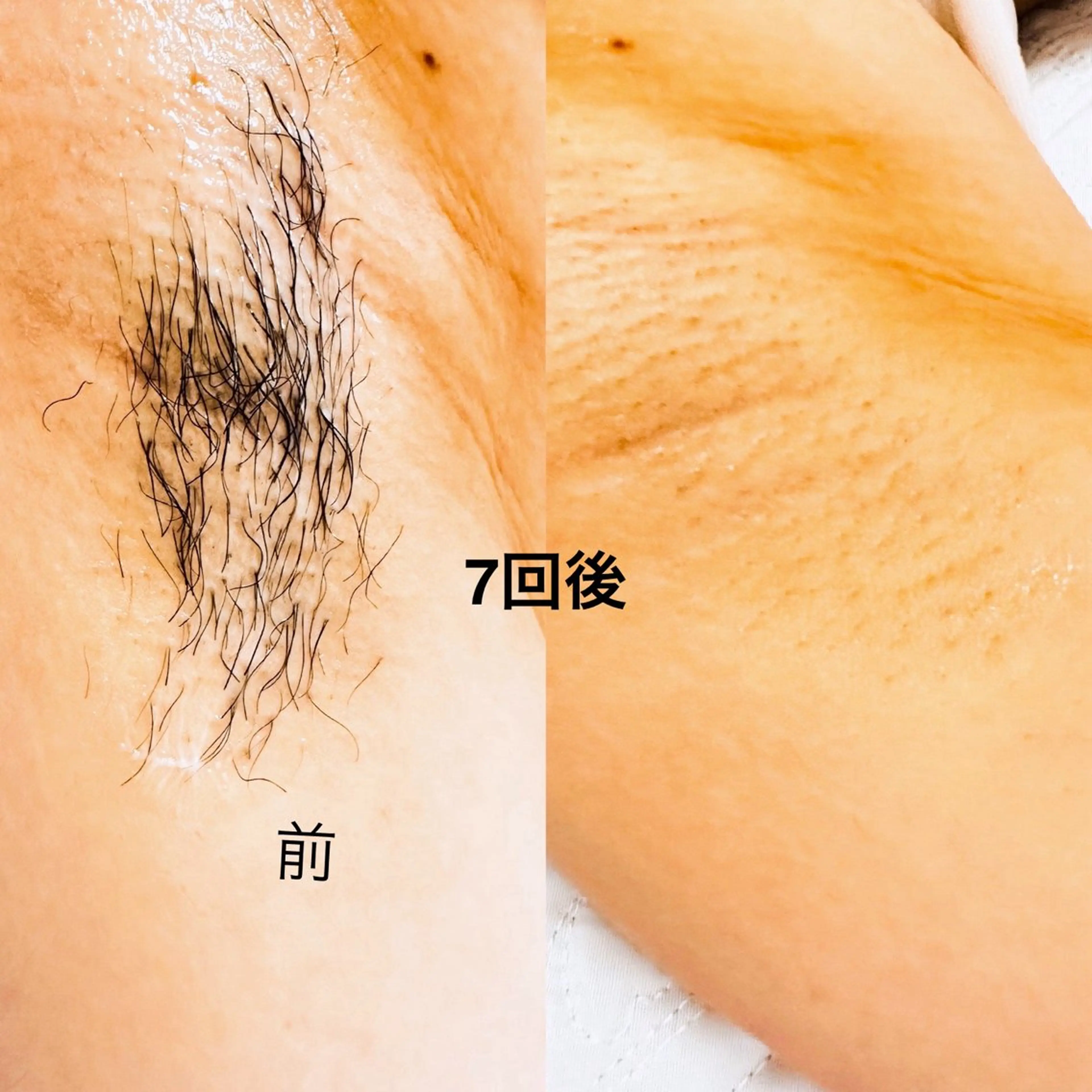 Thu Huyen Beauty所属・トウ フェンのエステ・リラクイメージ