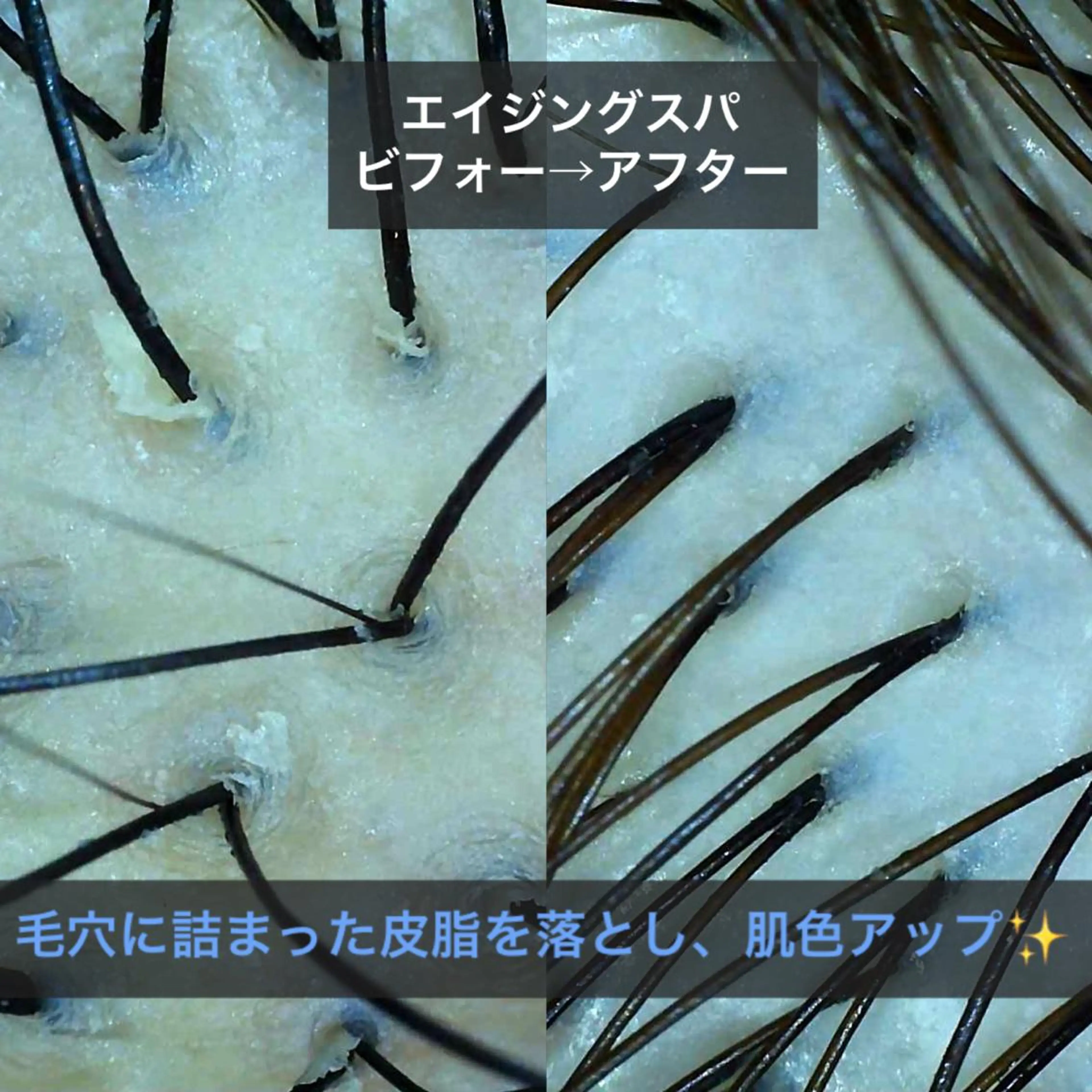 【リカバリーエステカットコース】カット+エイジングスパ+育毛ケア✨髪を作る細胞へ濃厚栄養成分を浸透させることでハリツヤ髪の写真