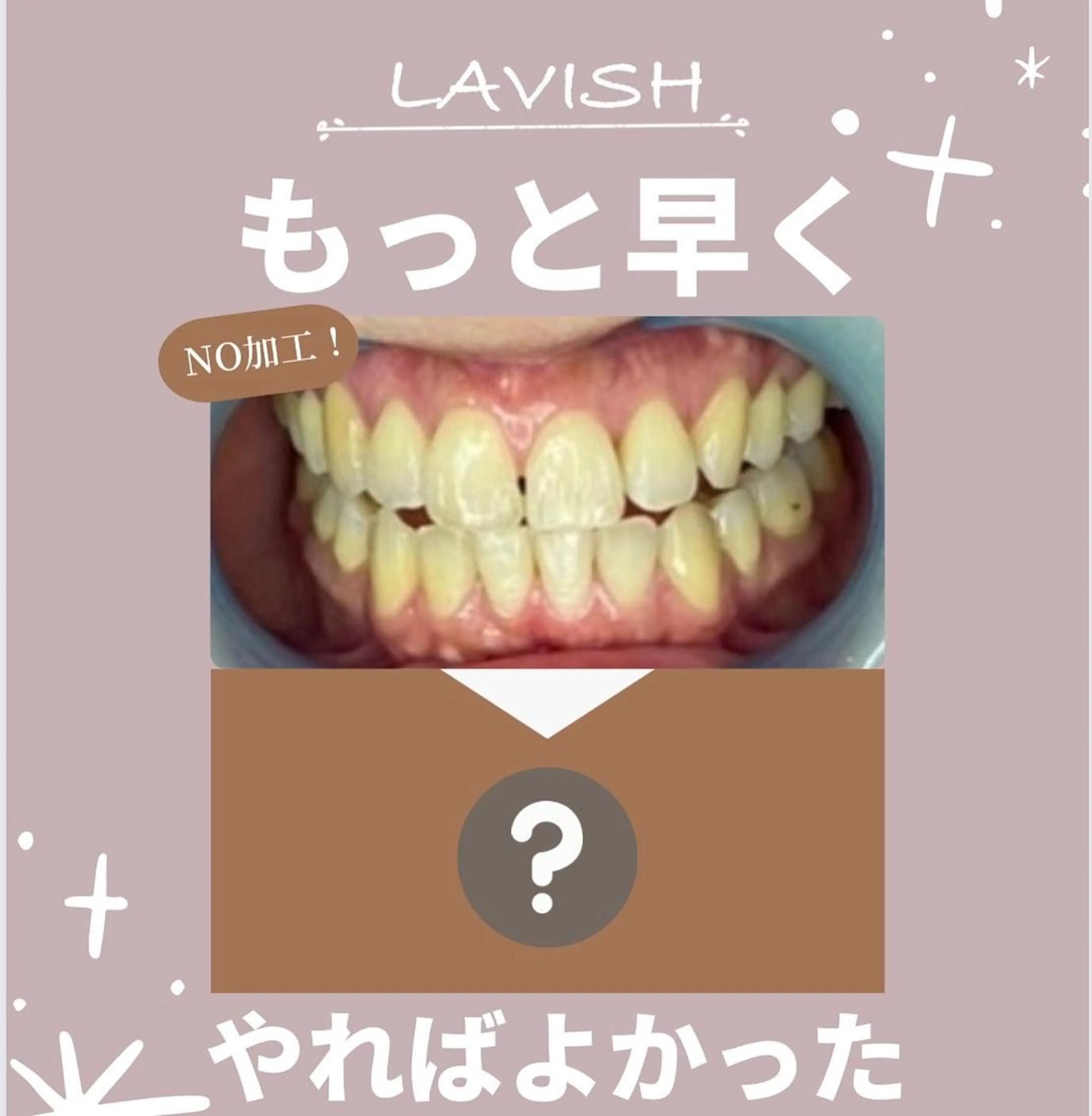 LAVISH nail salonのネイルデザイン