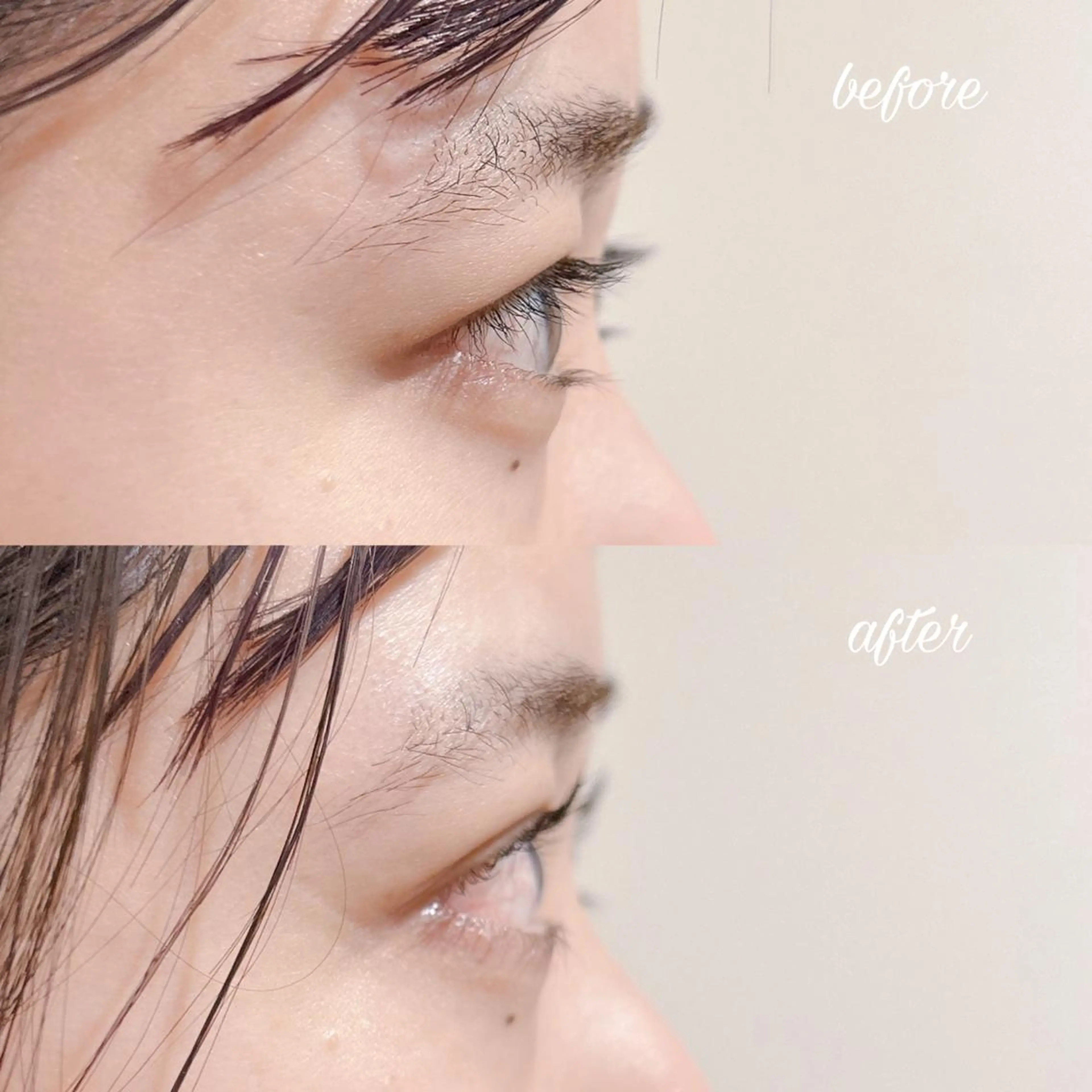 マツエク・マツパ マツパ merveilles所属・まつげ/整体/にきび ・アトピー専門サロンのマツエク・マツパデザイン