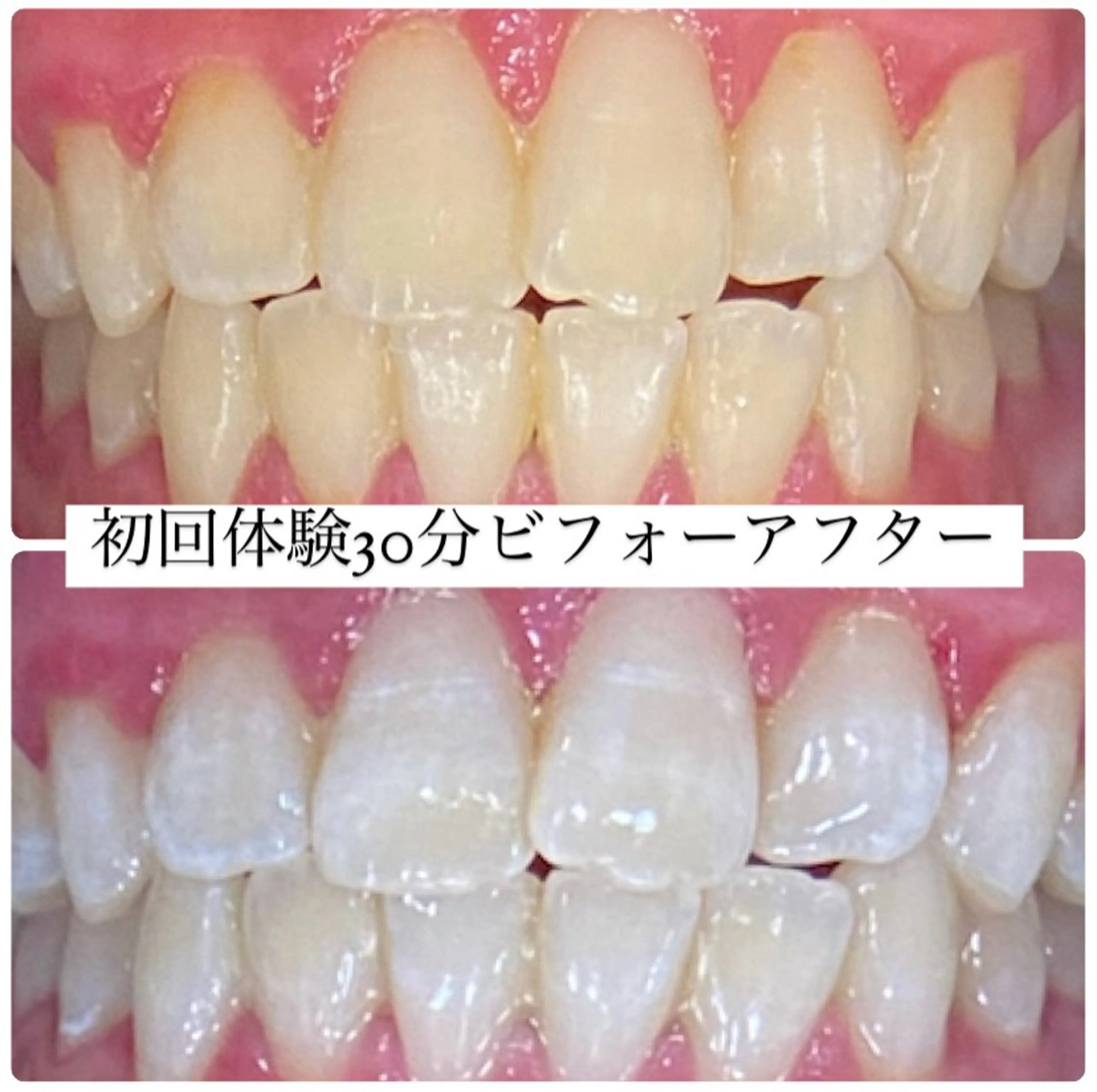 PLATINUM Beauty 横浜店所属・ホワイトニングルーム 横浜店のその他イメージ