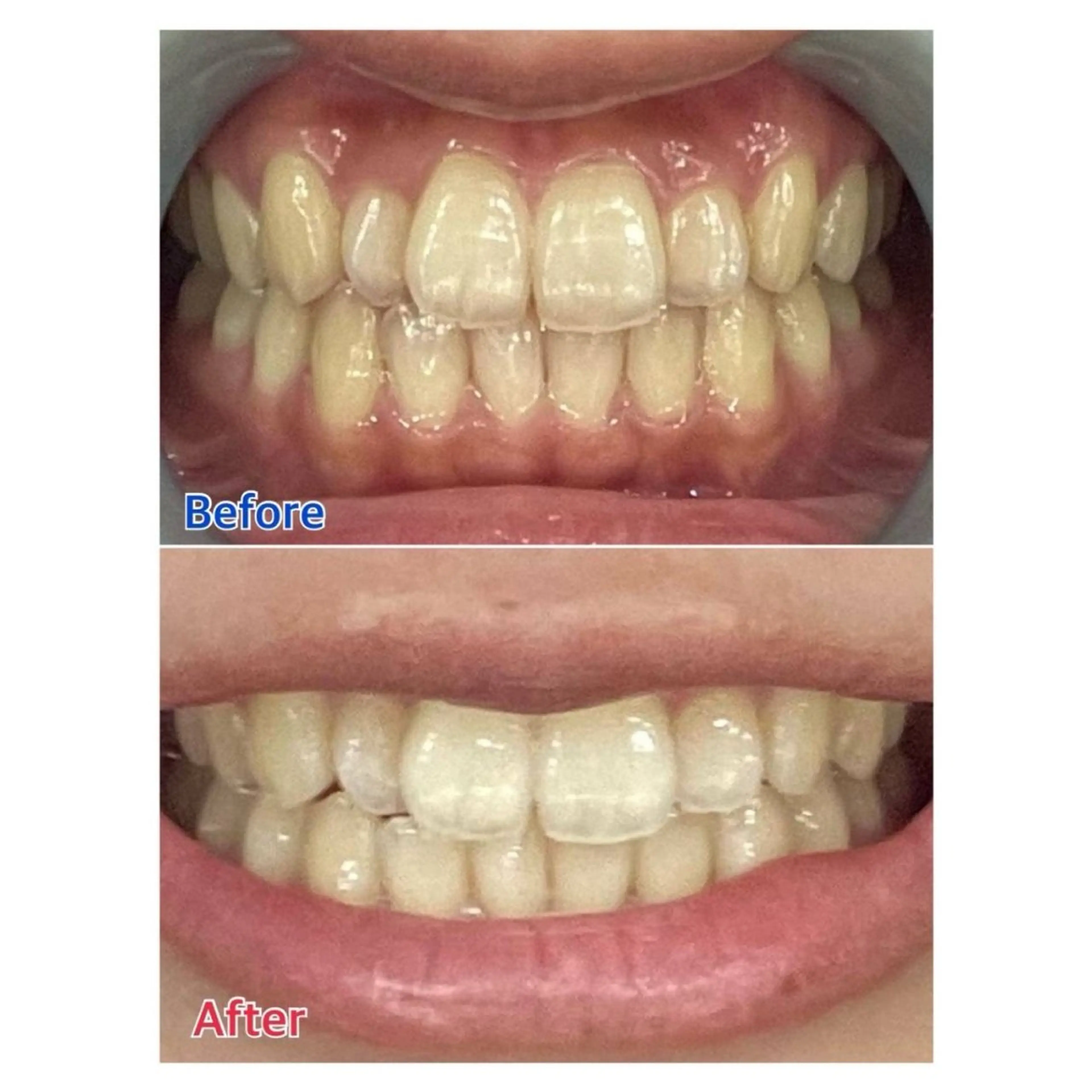 MBEAUTYSALON 千葉店・京成大久保所属・Melty 輝のその他イメージ